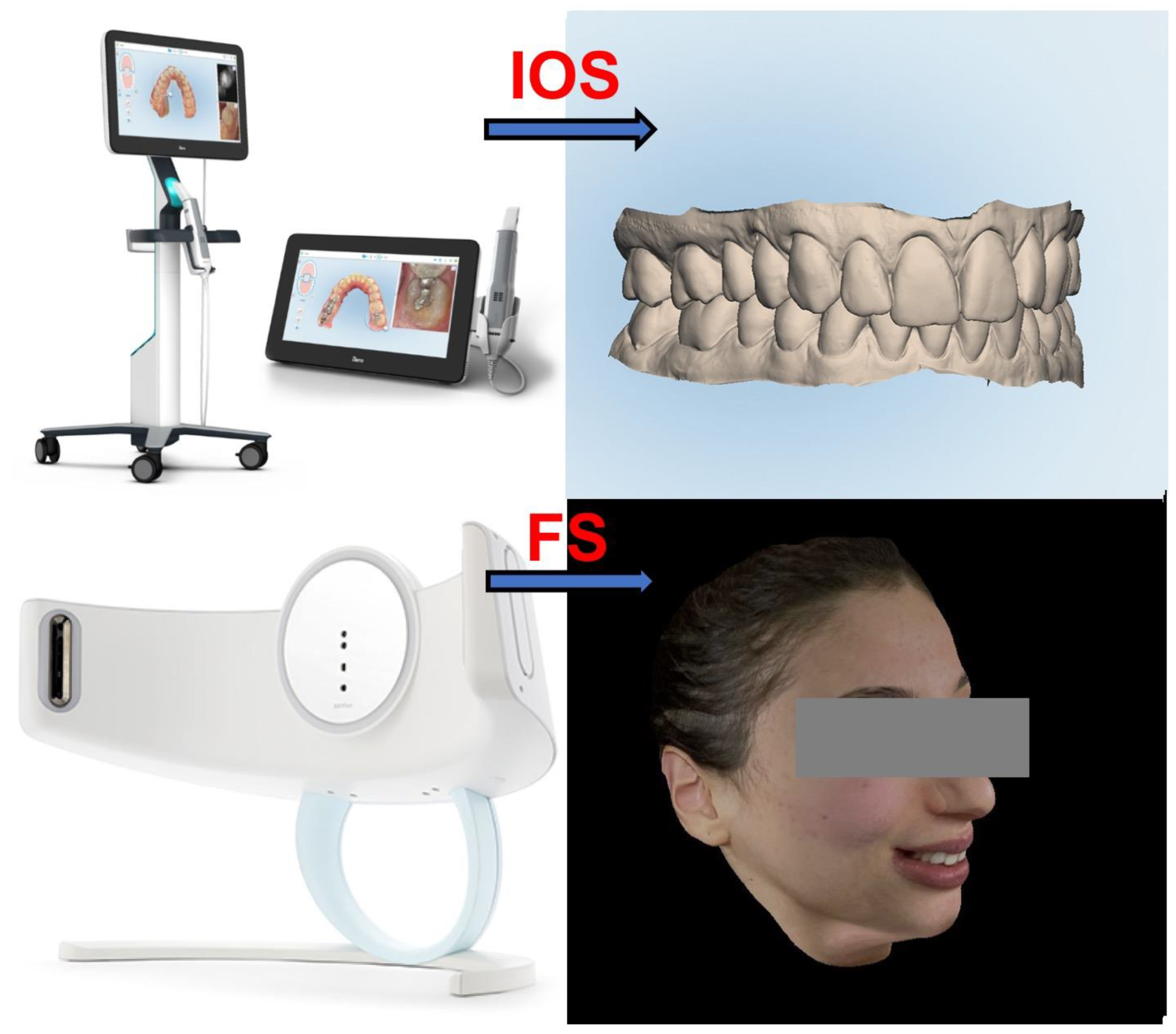 Applied Sciences | Free Full-Text | From Reverse Engineering Software to CAD -CAM Systems: How Digital Environment Has Influenced the Clinical  Applications in Modern Dentistry and Orthodontics