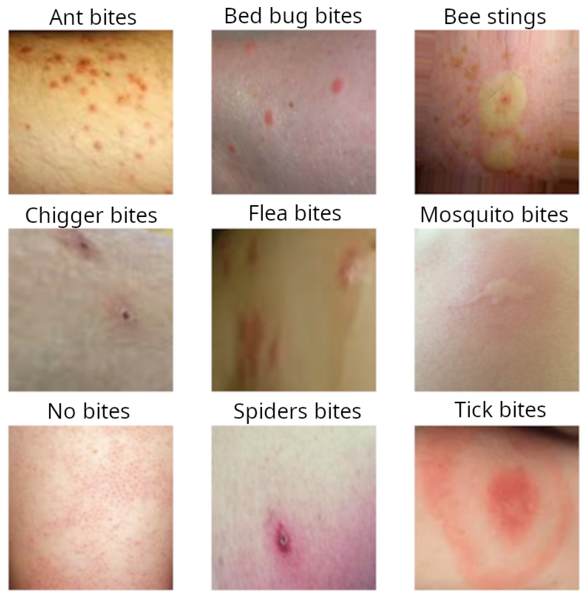 Tick Bite Identification Serydesigners