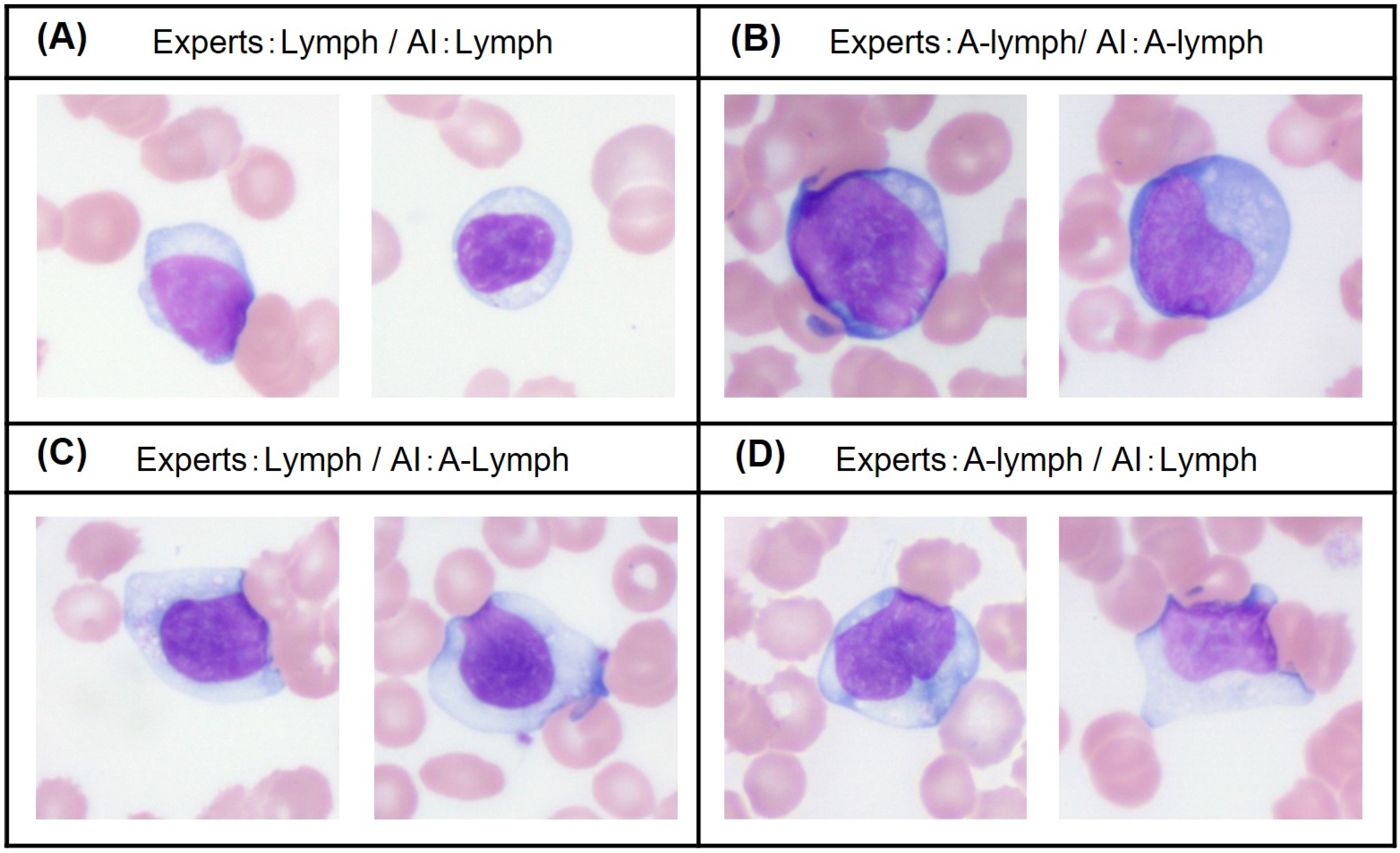 reactive lymphocytes vs monocytes