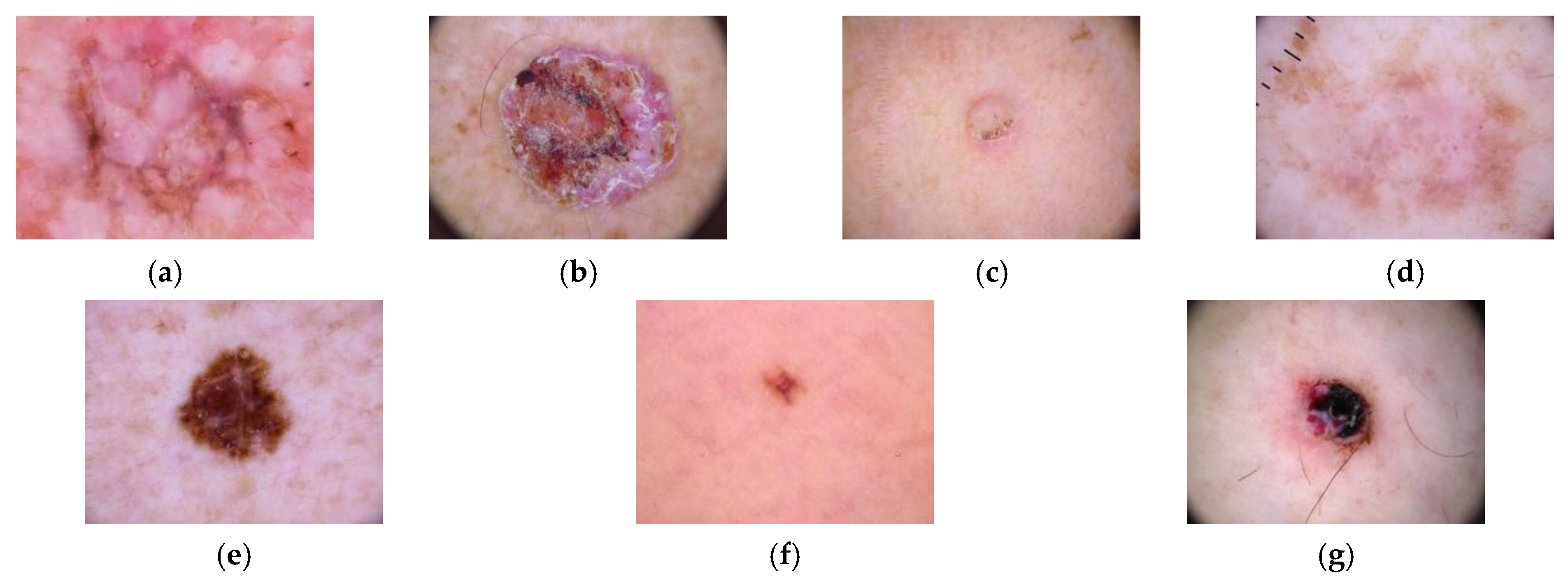 Applied Sciences | Free Full-Text | Skin Lesion Classification Using ...