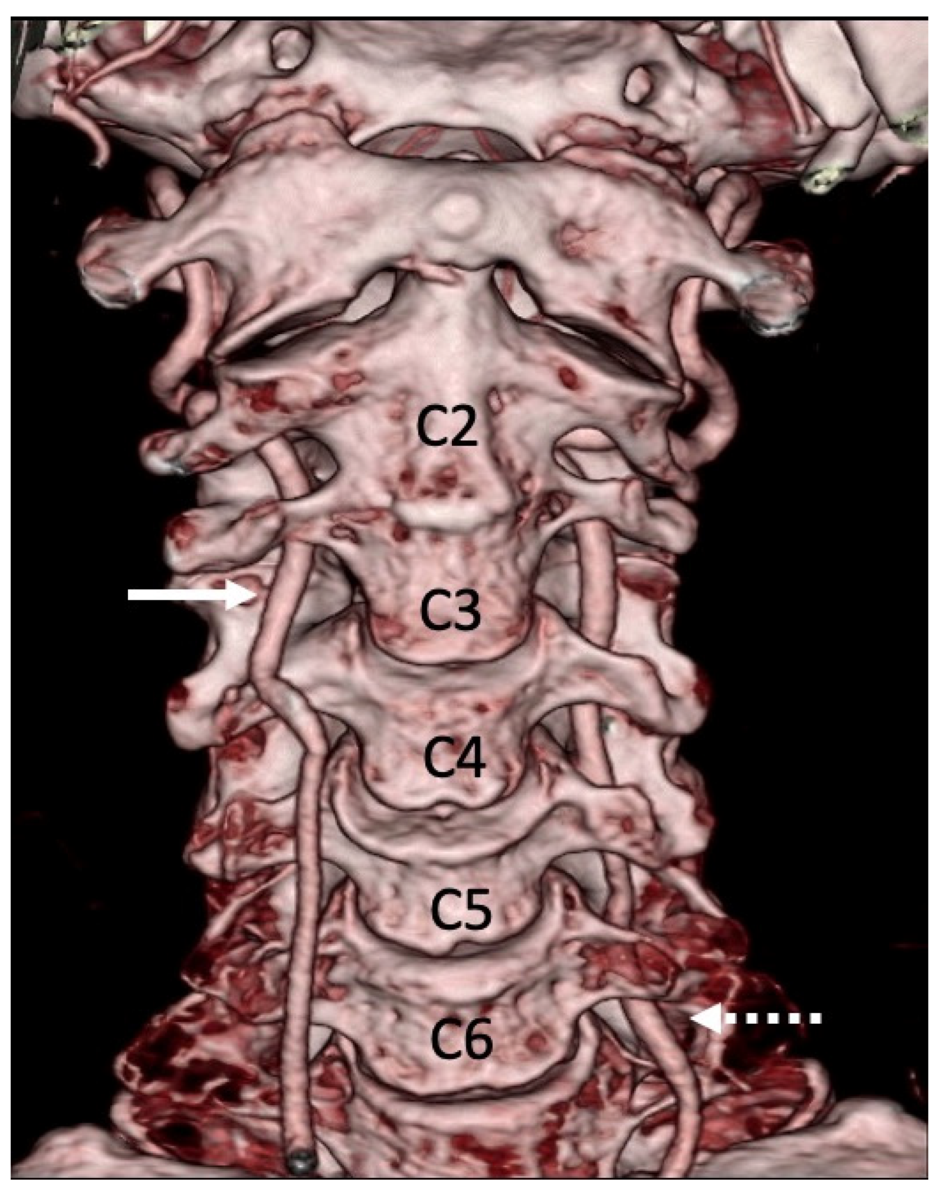 Applied Sciences Free Full Text Radiological Assessment Of