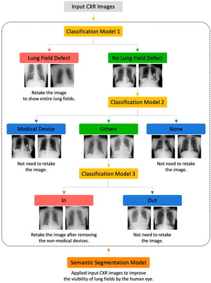 Applied Sciences | Free Full-Text | Development of Chest X-ray Image ...