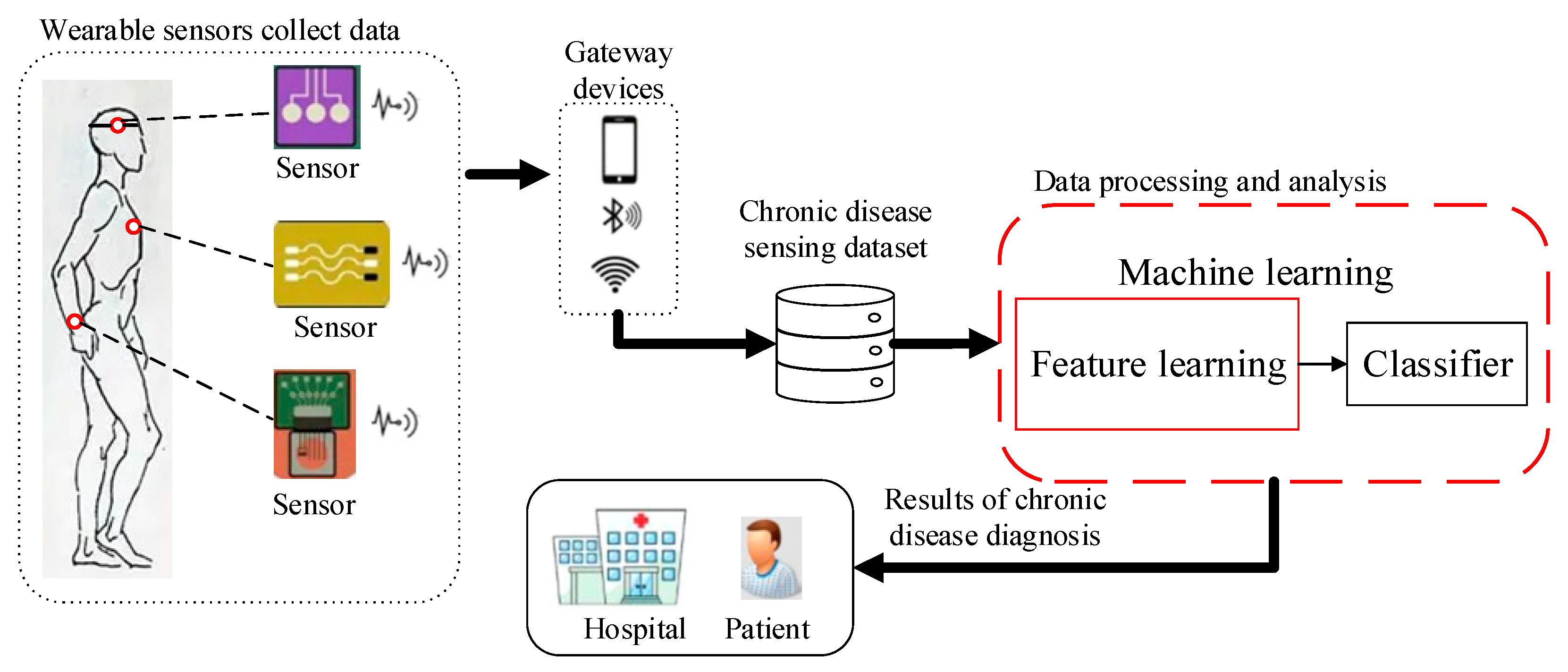 A DFS network example with a feature selection layer (where w is the