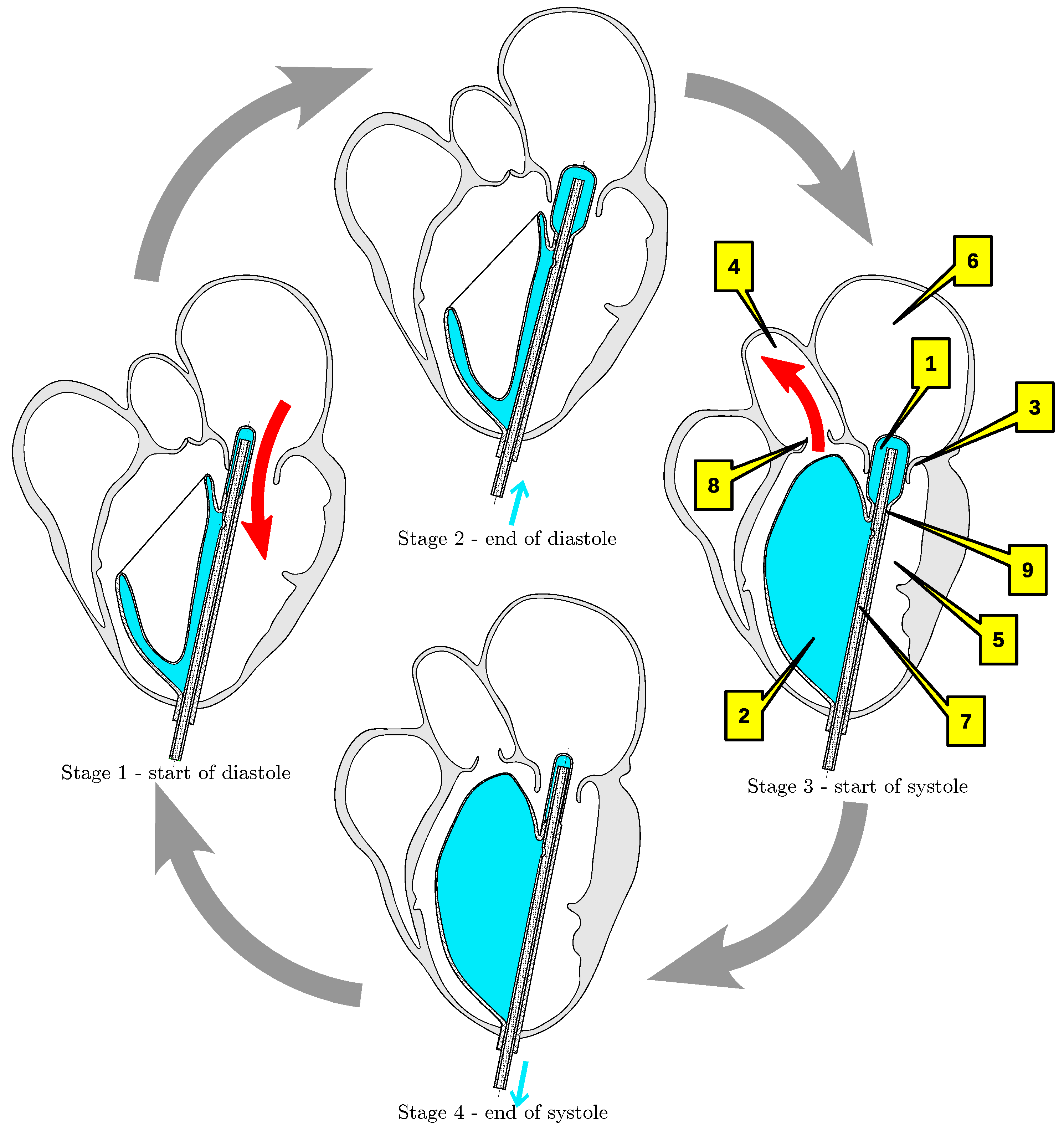 Left Ventricular Assist Devices: A Primer For the General Cardiologist