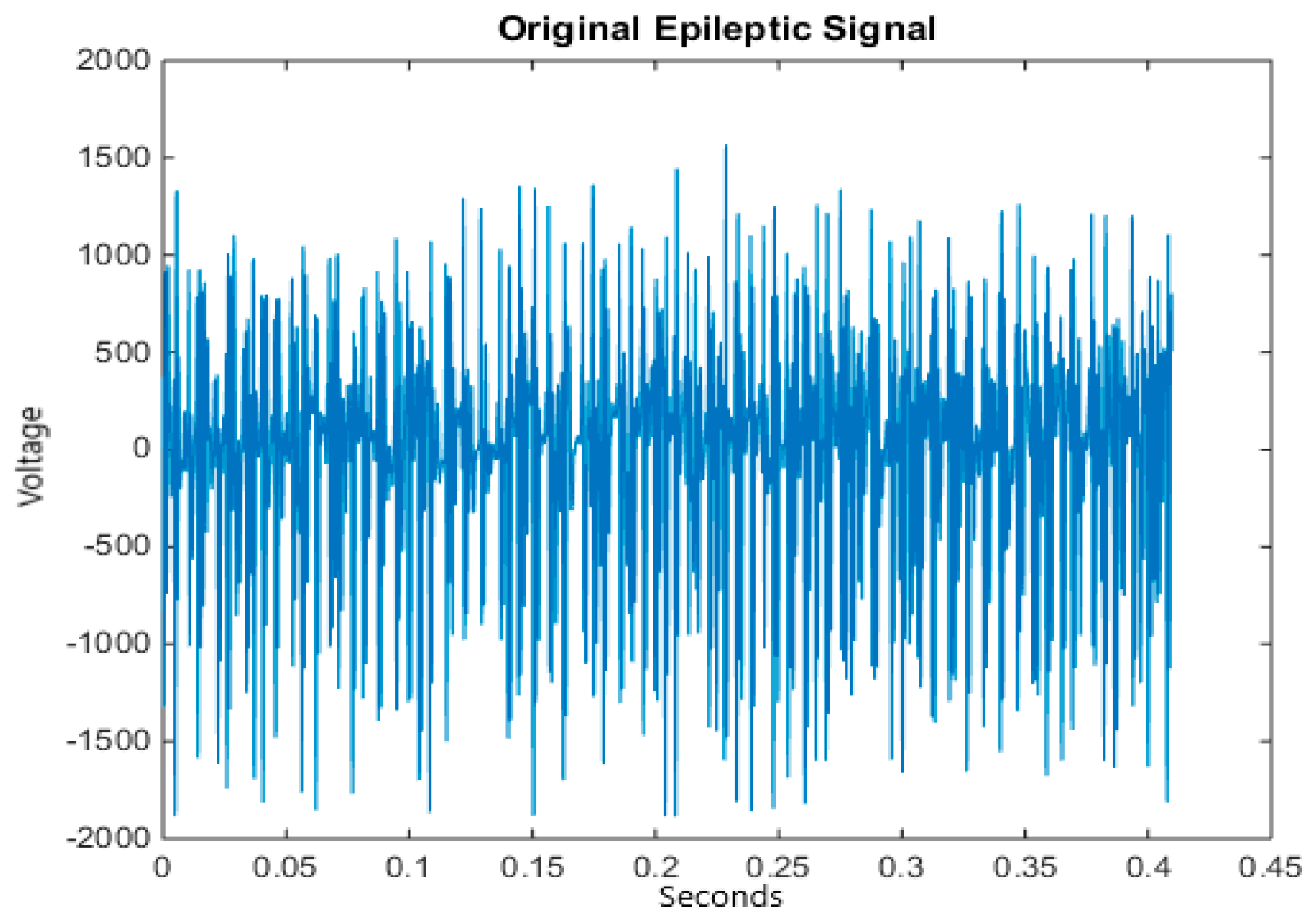 Applied Sciences | Free Full-Text | An Epileptic Seizure Detection ...