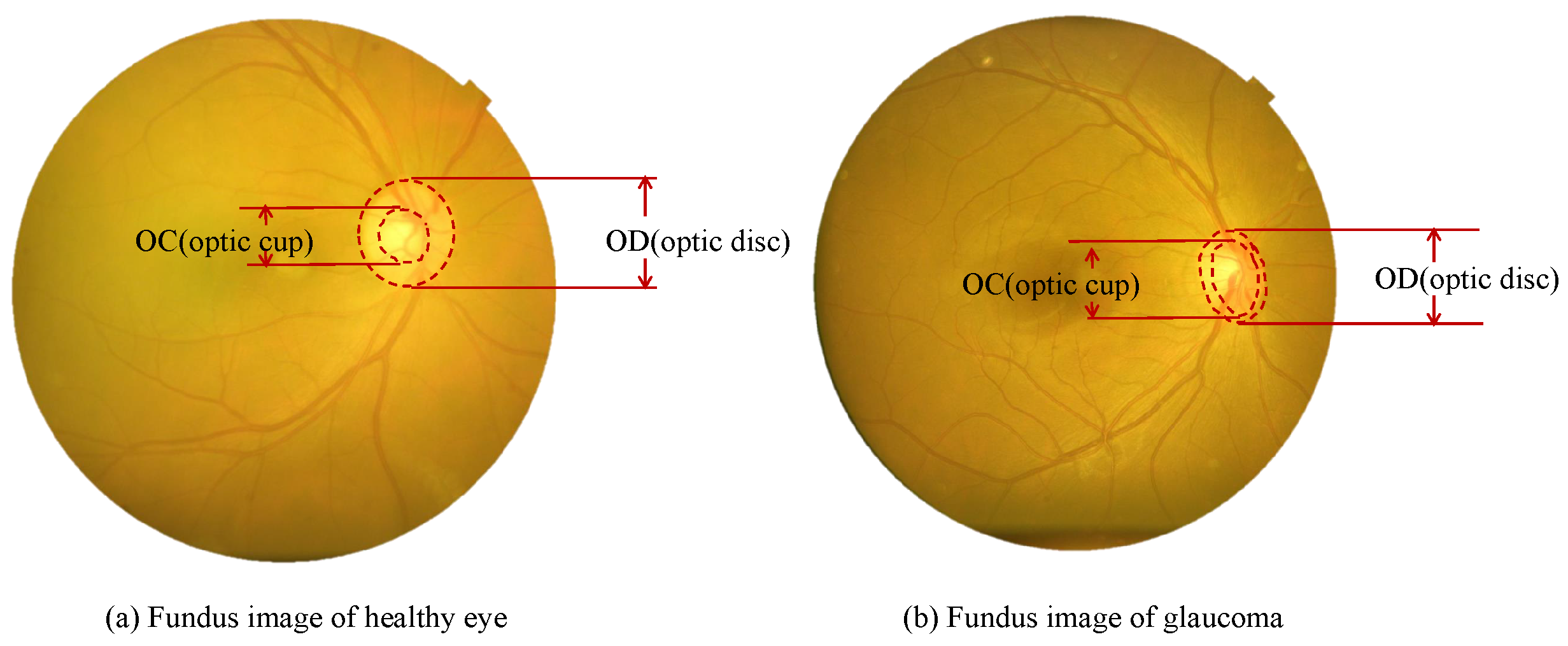 Applied Sciences | Free Full-Text | BEAC-Net: Boundary-Enhanced Adaptive  Context Network for Optic Disk and Optic Cup Segmentation