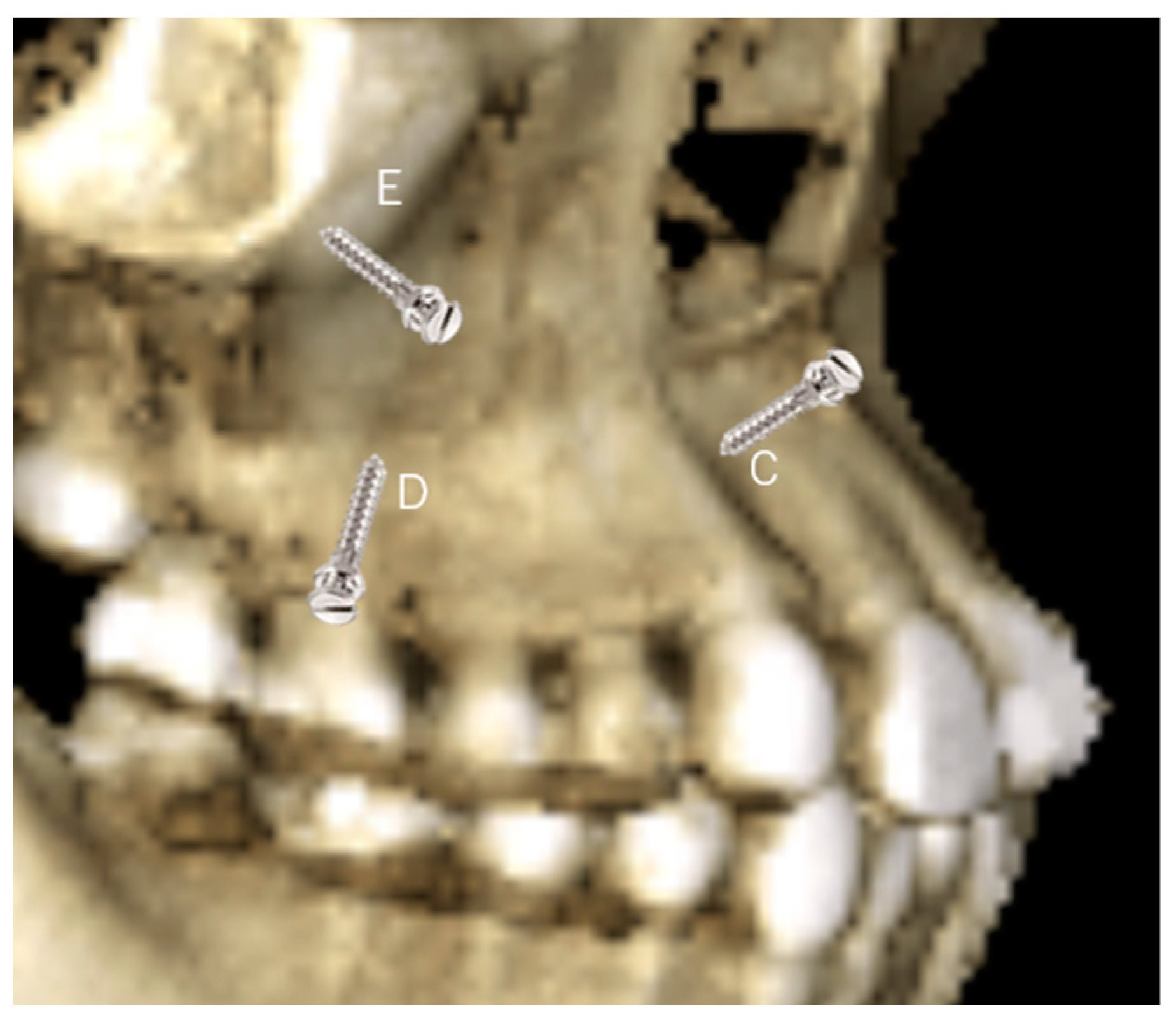 Applsci 13 10332 g002 Applsci 13 10332 g002