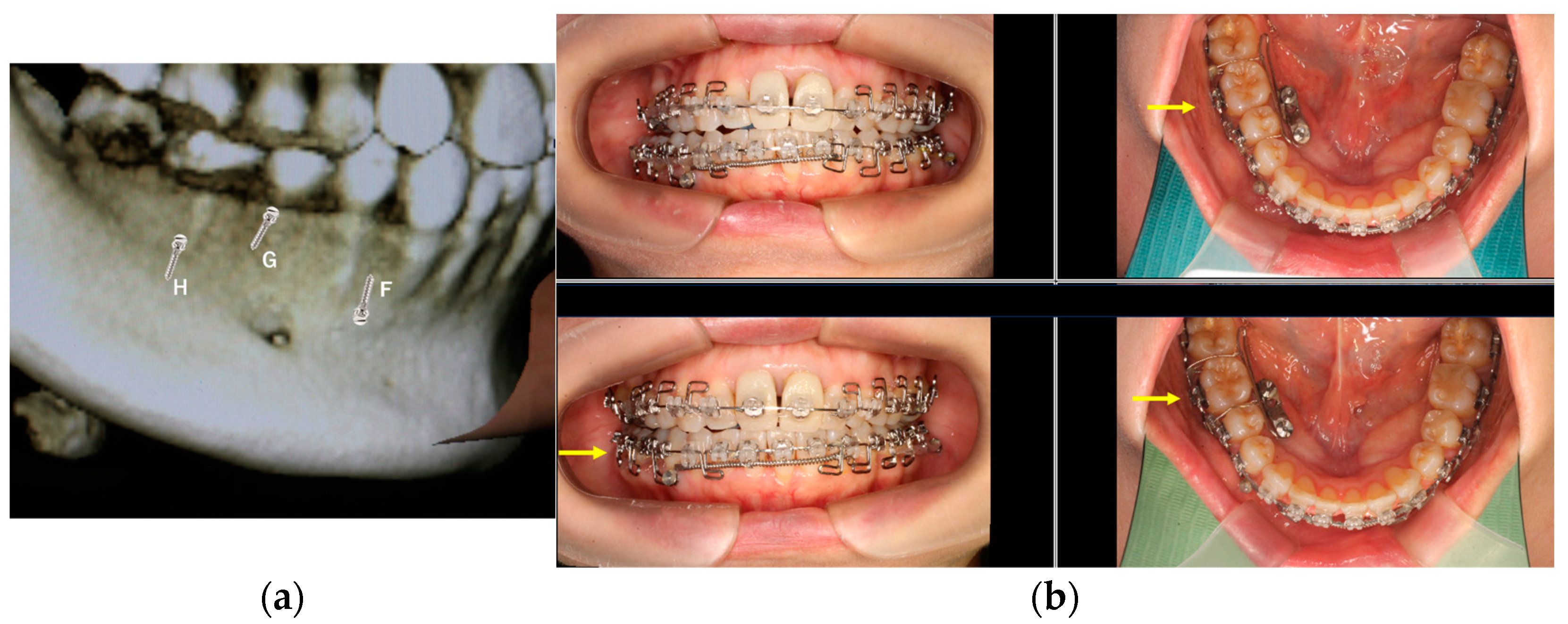Applsci 13 10332 g003 Applsci 13 10332 g003