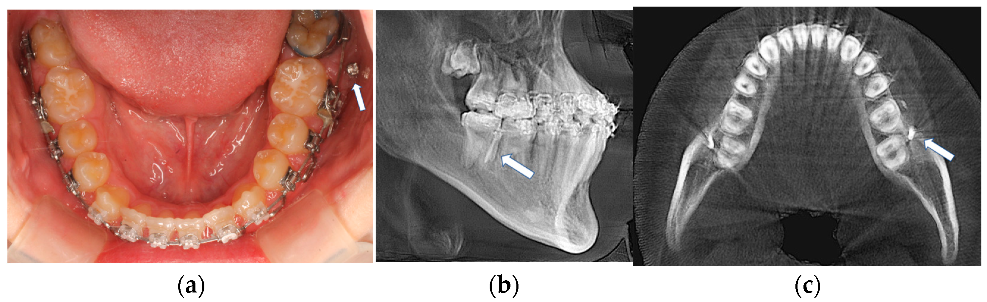 Applsci 13 10332 g004 Applsci 13 10332 g004
