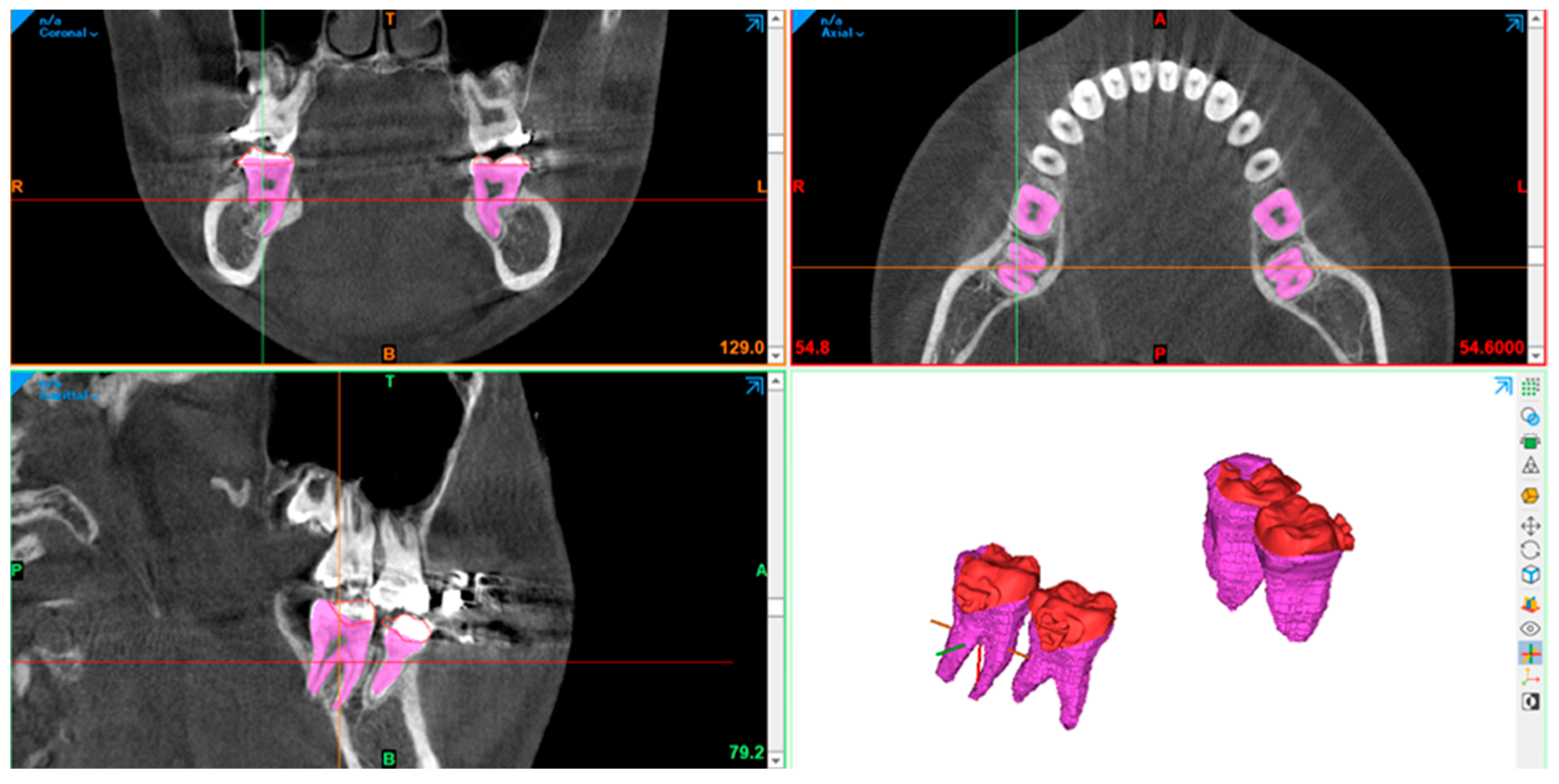 Applsci 13 10332 g007 Applsci 13 10332 g007