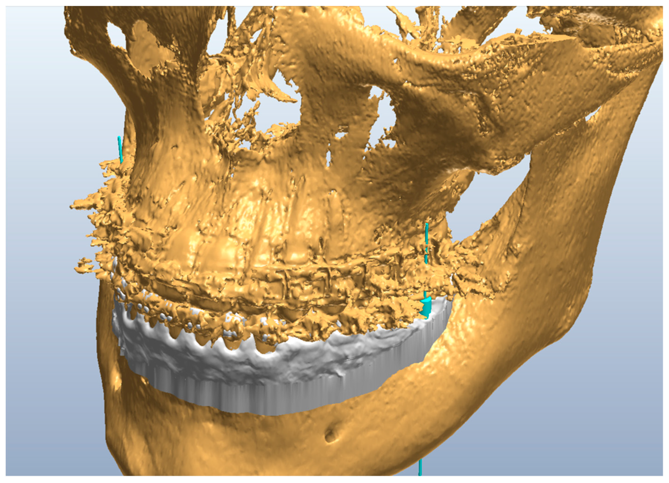 Applsci 13 10332 g011 Applsci 13 10332 g011