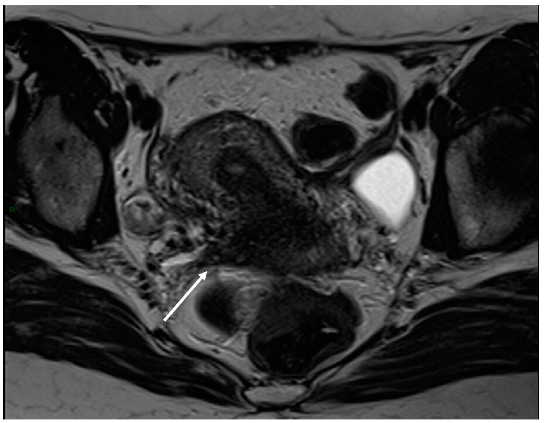 Applsci 13 10509 g003 Applsci 13 10509 g003