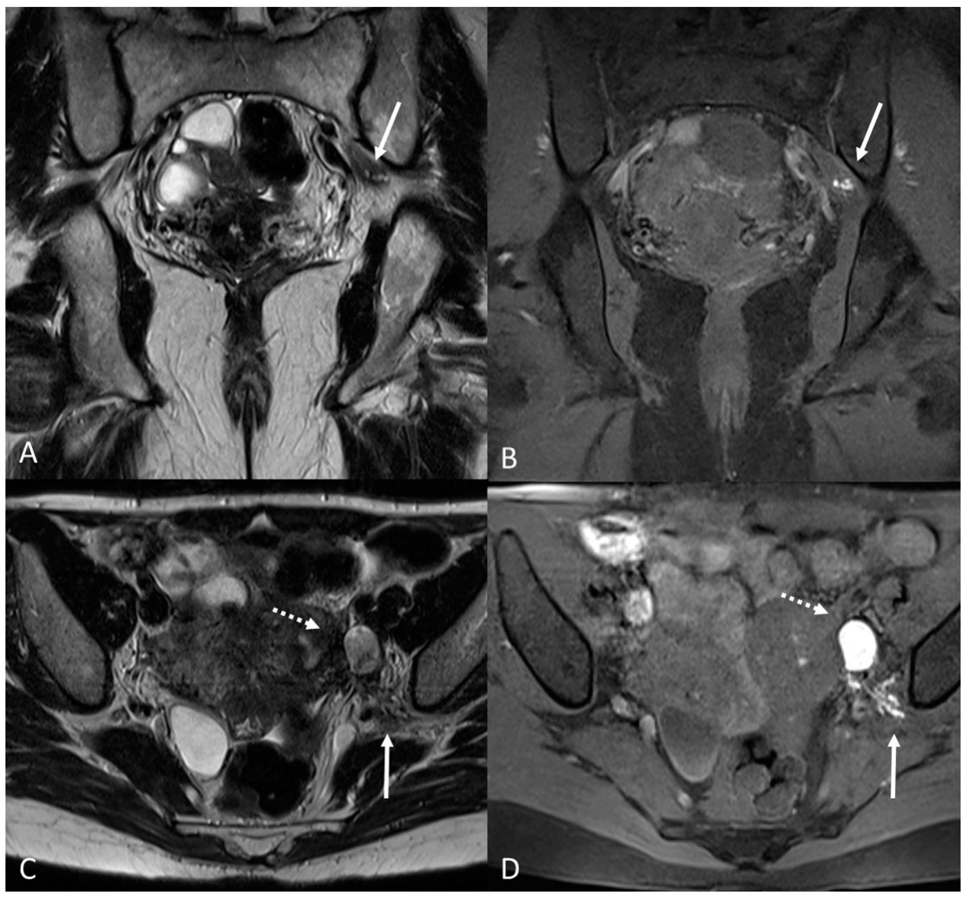 Applsci 13 10509 g014 Applsci 13 10509 g014