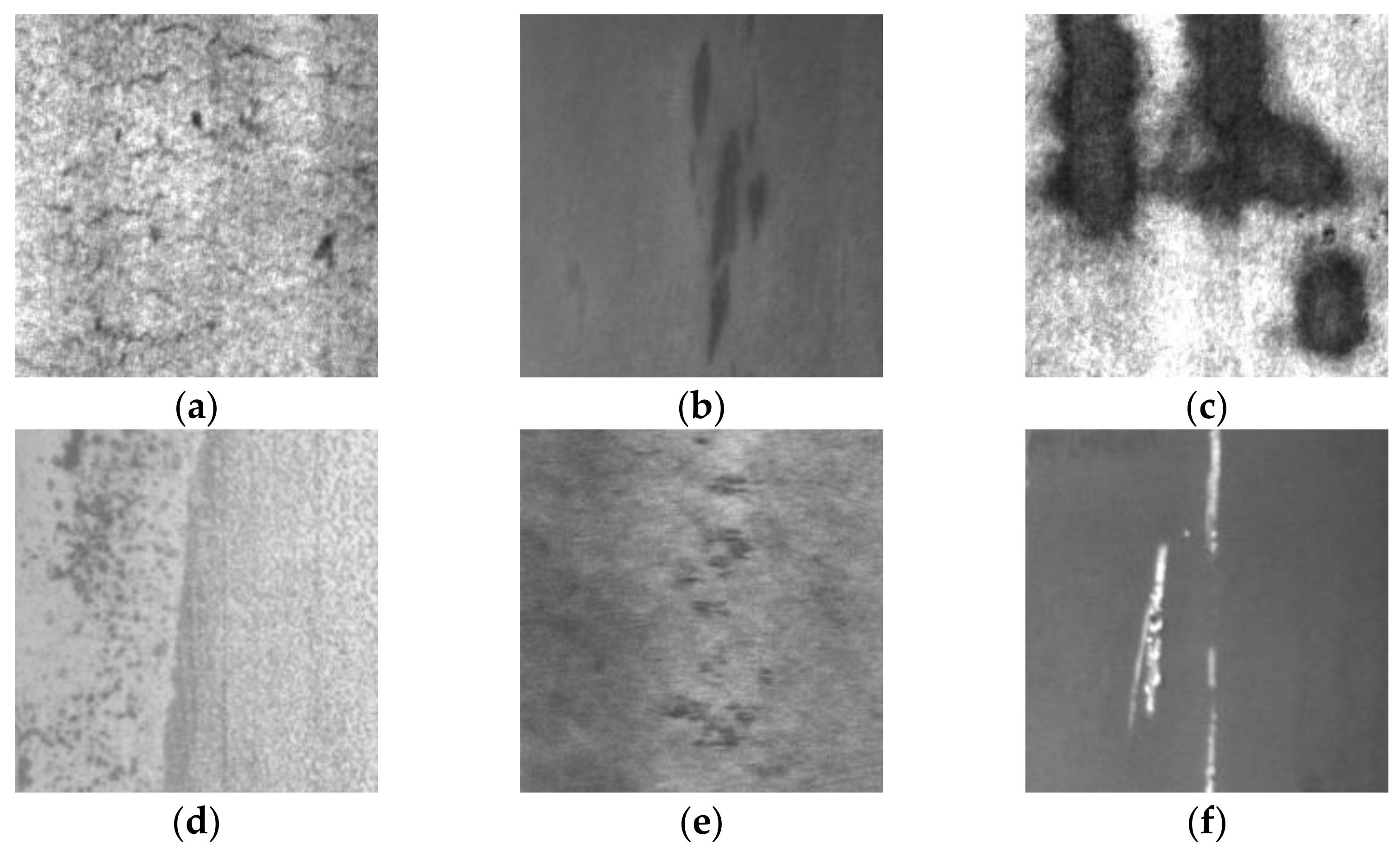 An Enhanced YOLOv5-Based Algorithm for Metal Surface Defect Detection