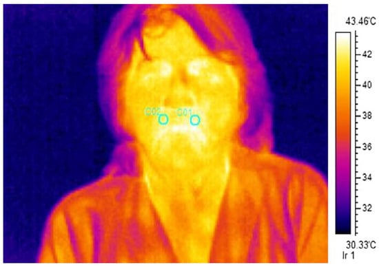 Seeing is Believing Breast Thermal Image in Rainbow