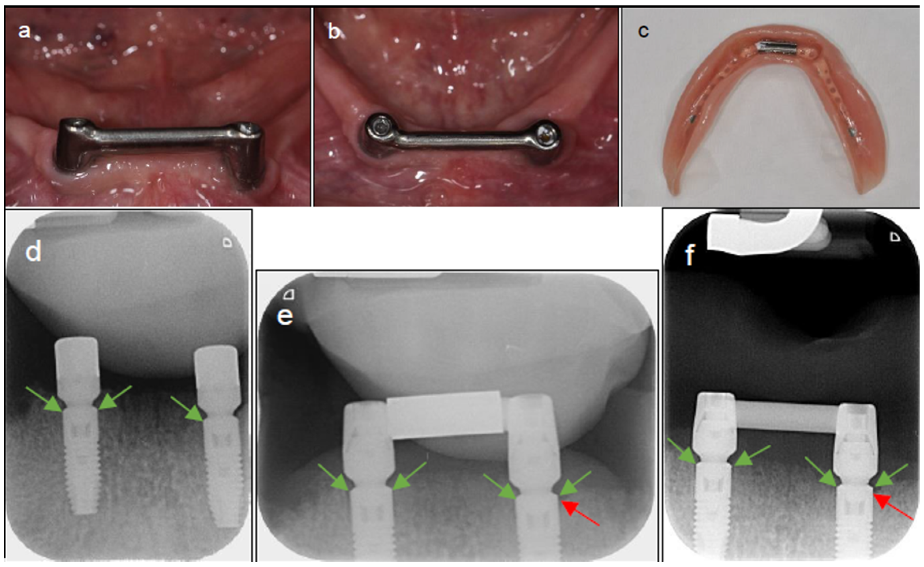 Applsci 14 01658 g002