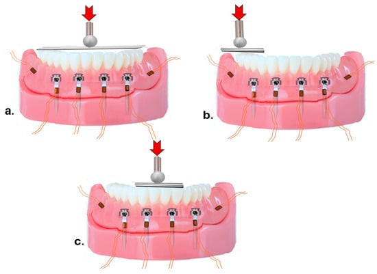 Managing the 'pink bits' of prosthodontics