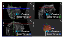 Applsci 14 02152 i014 Applsci 14 02152 i014
