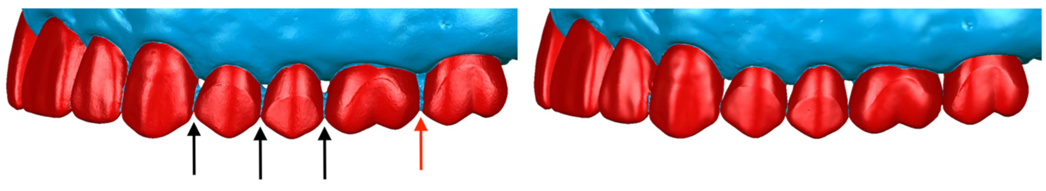 Applsci 14 02370 g011 Applsci 14 02370 g011