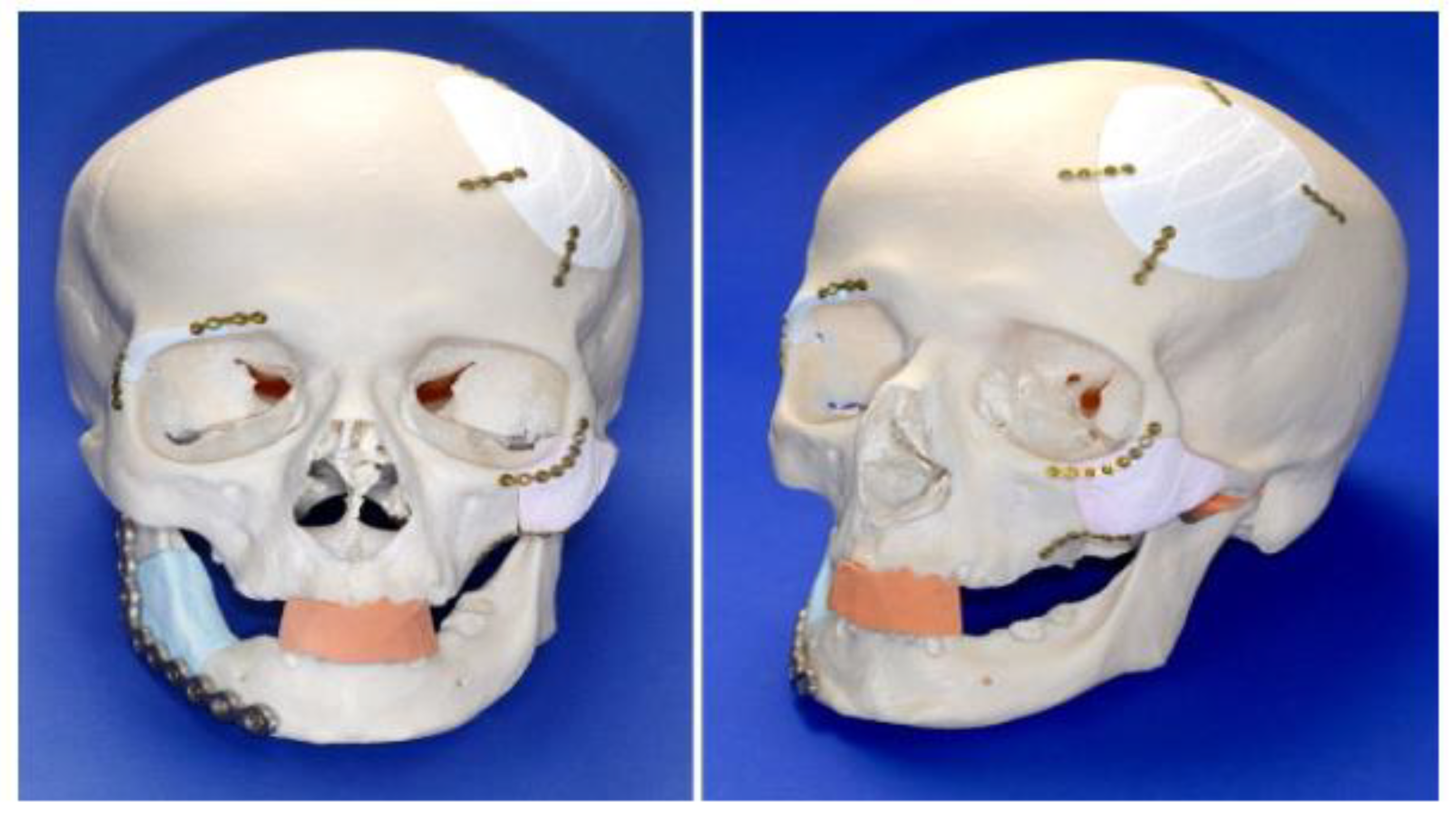 Applsci 14 02550 g010