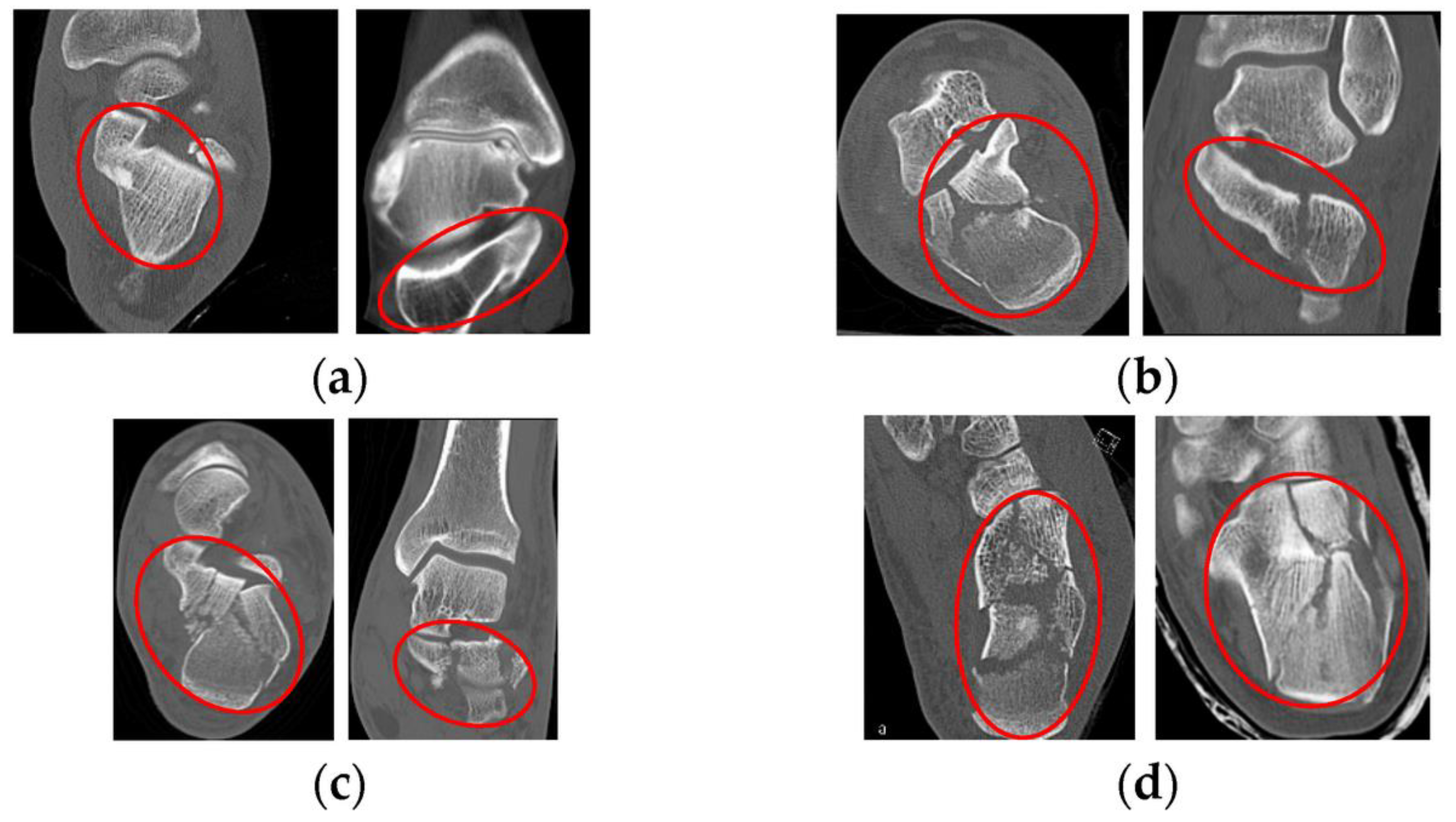 Applsci 14 02550 g013