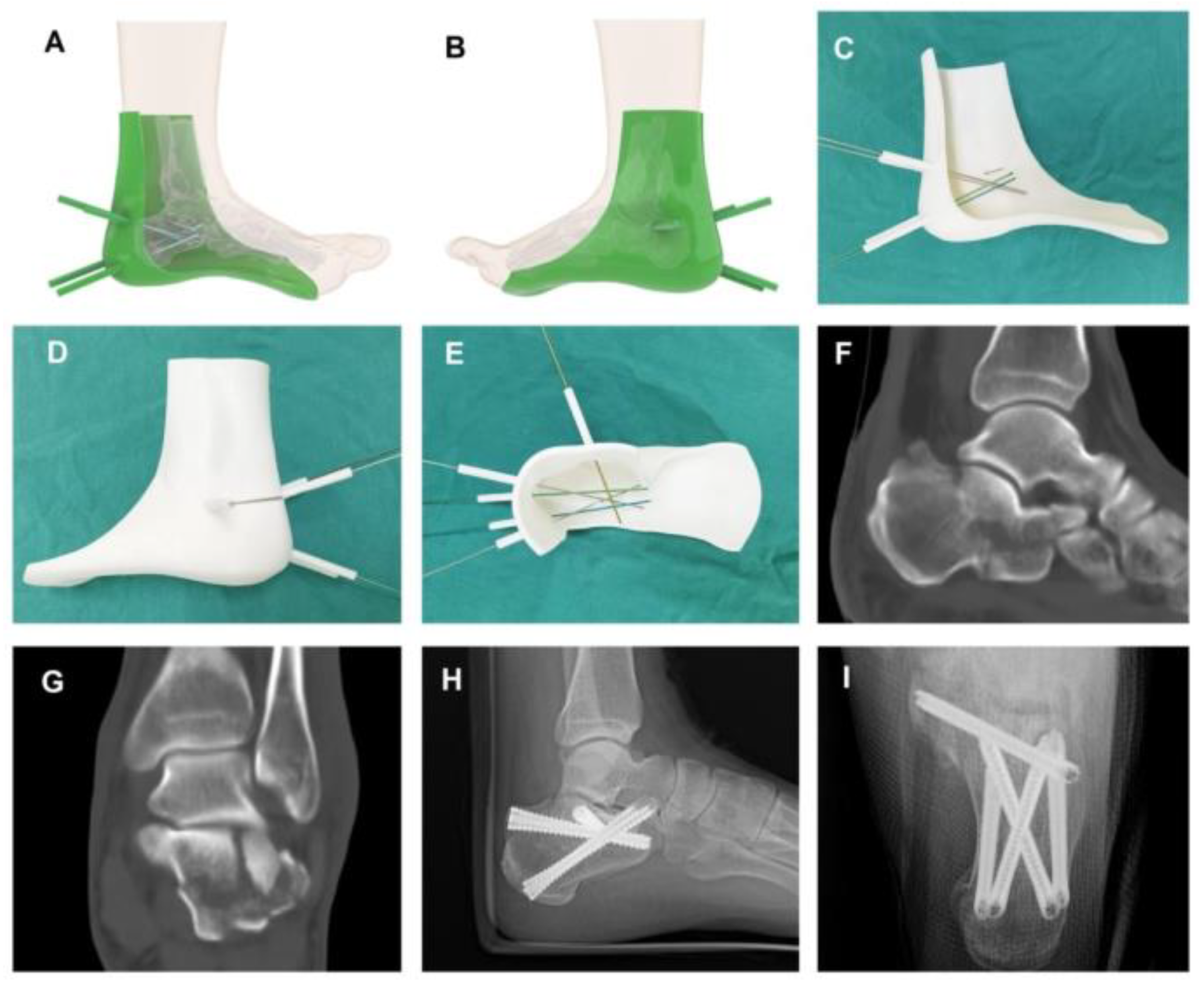 Applsci 14 02550 g014