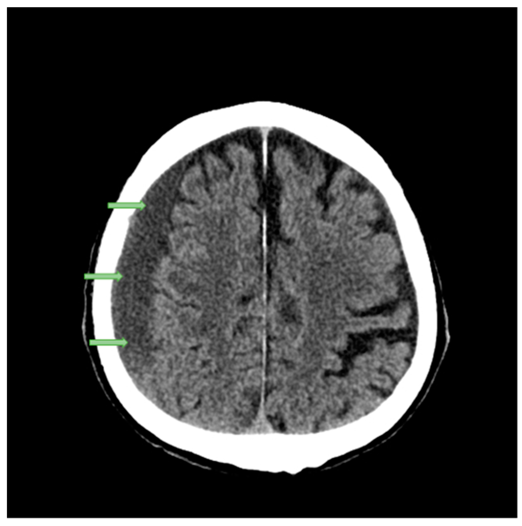 Applsci 14 02681 g003