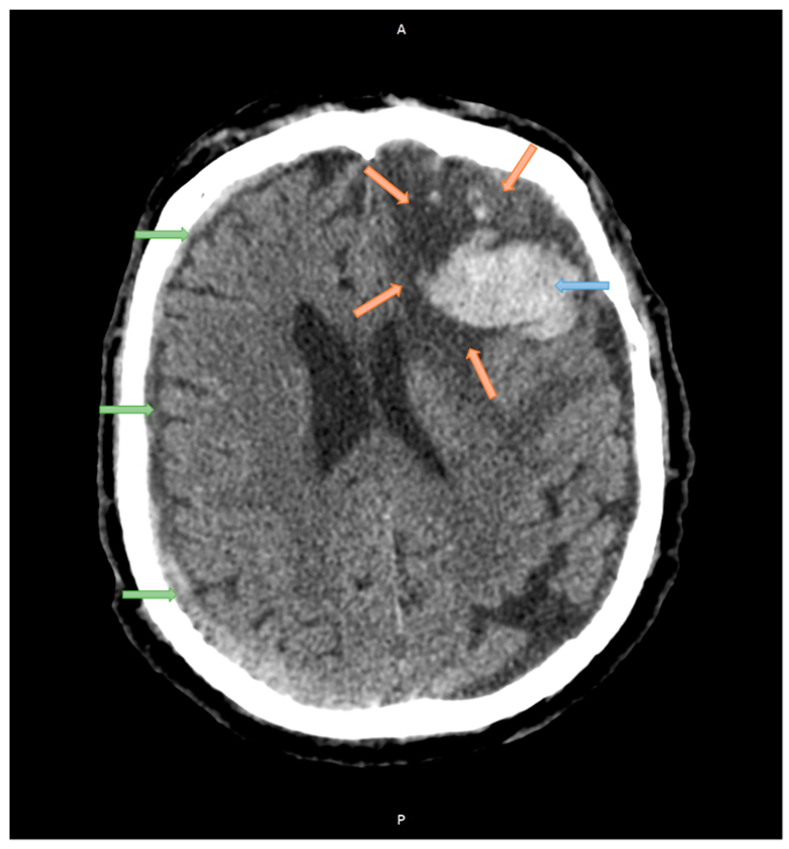 Applsci 14 02681 g005