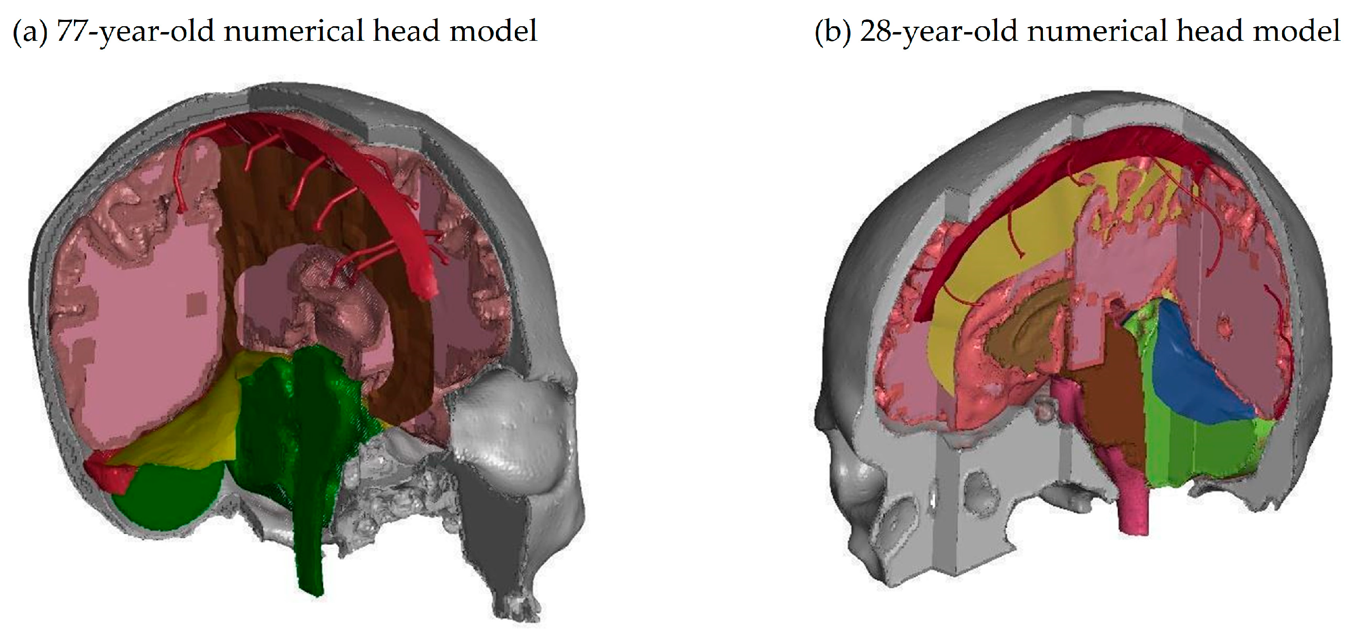 Applsci 14 02681 g006