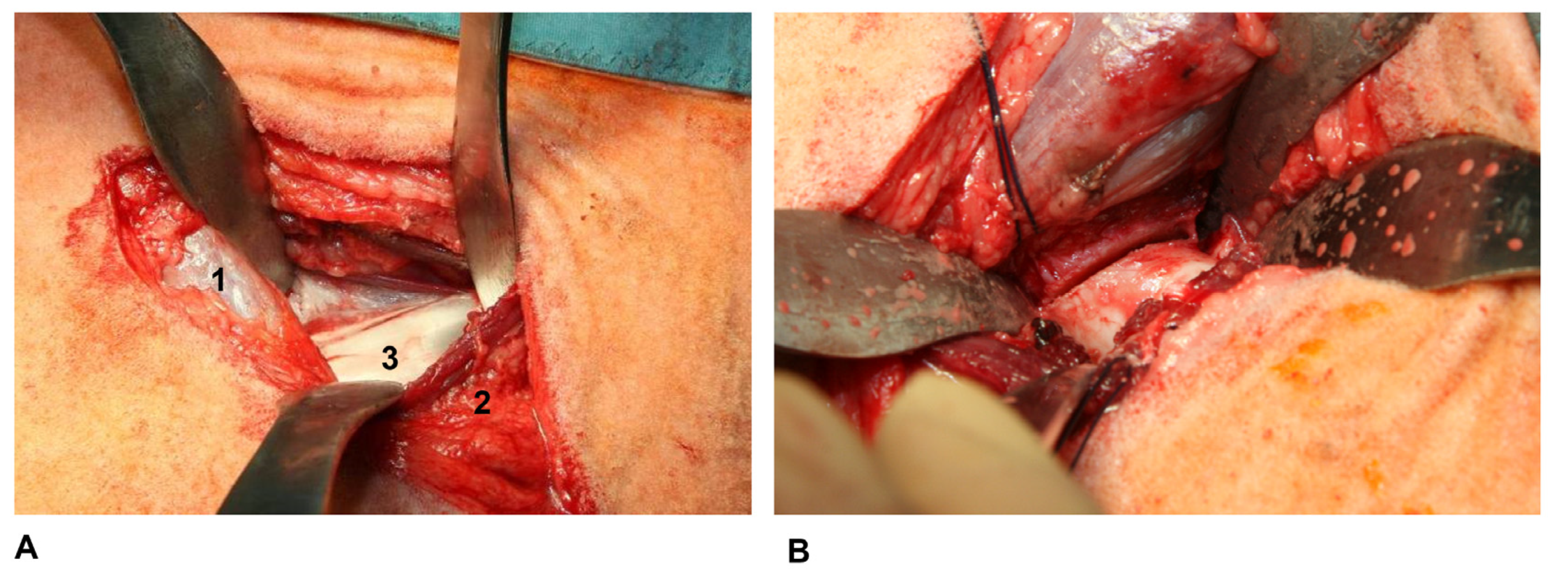 Applsci 14 03375 g003