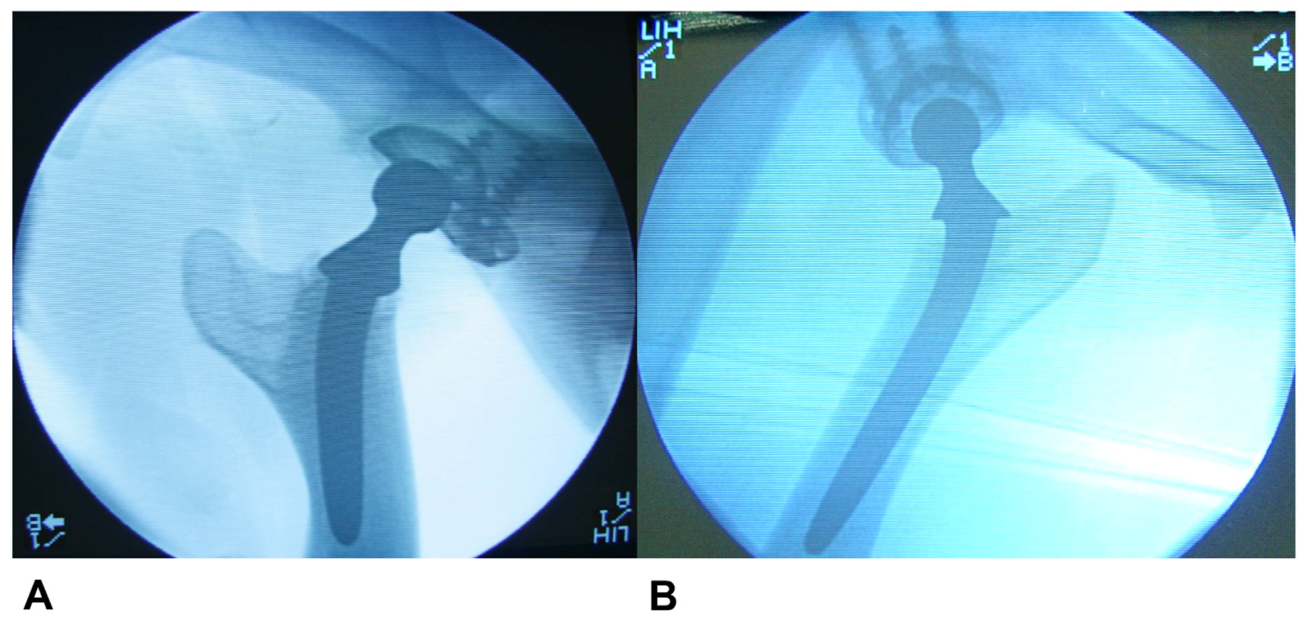 Applsci 14 03375 g006