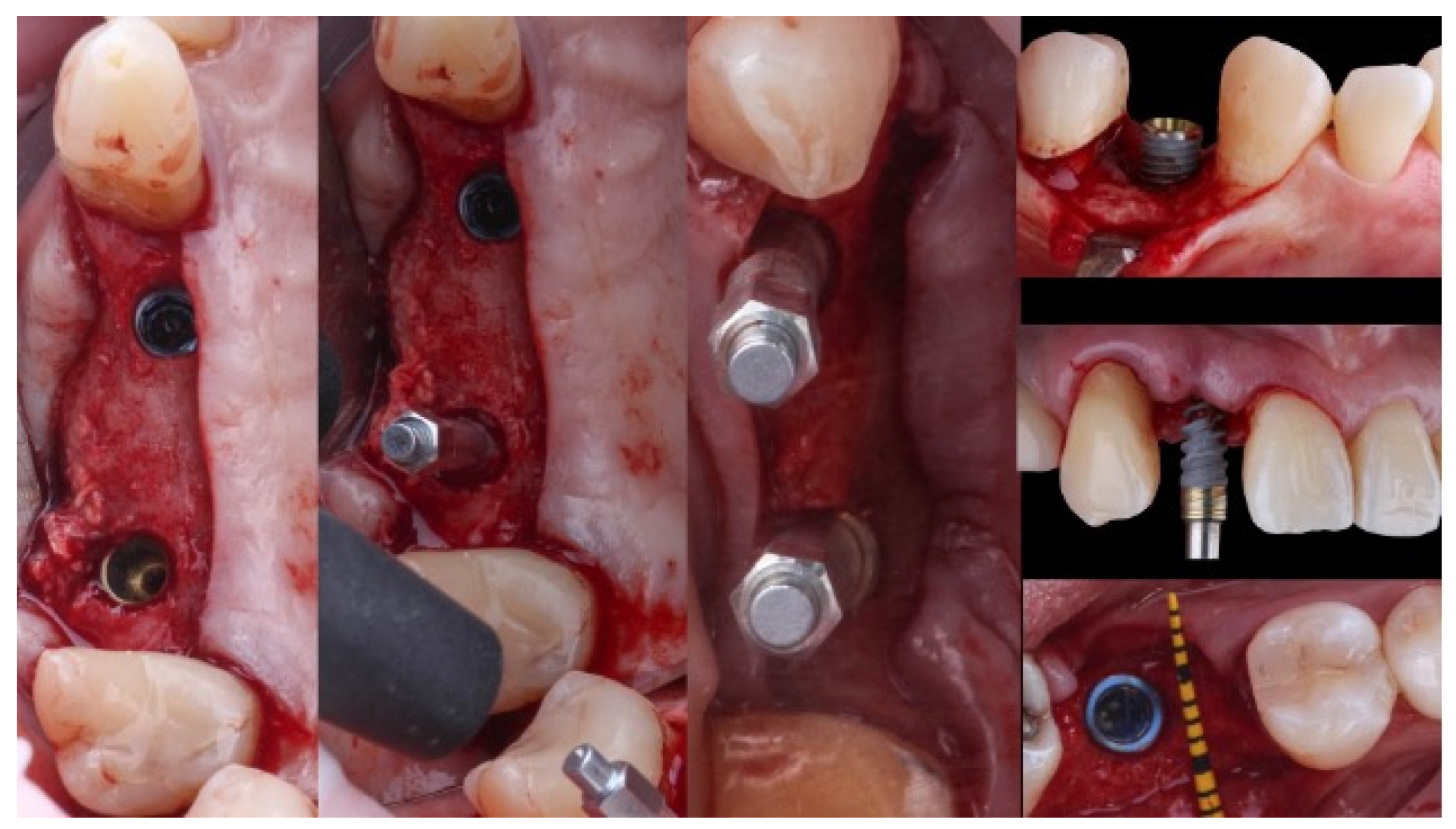 Applsci 14 04841 g002