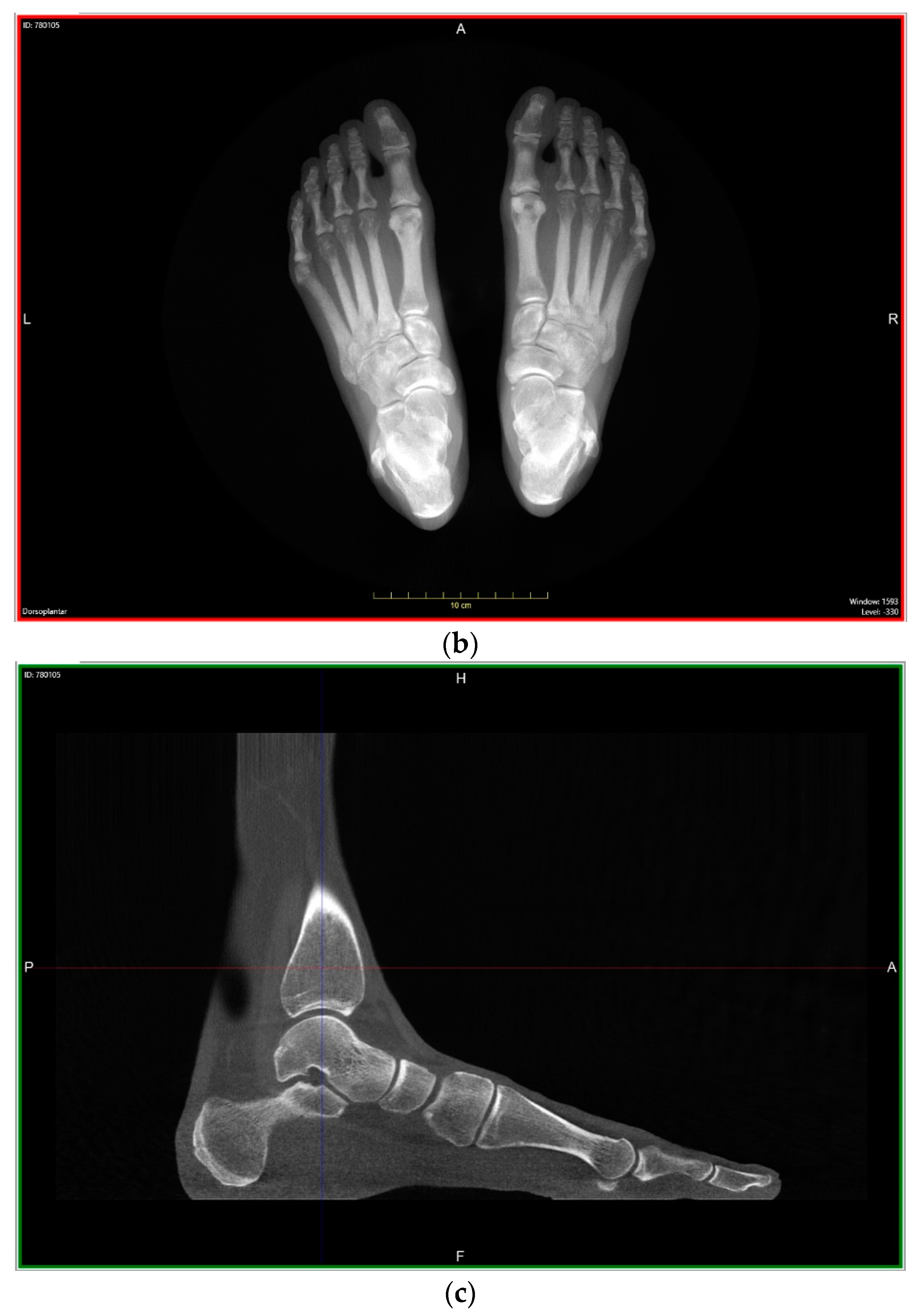 Applsci 14 05562 g002b