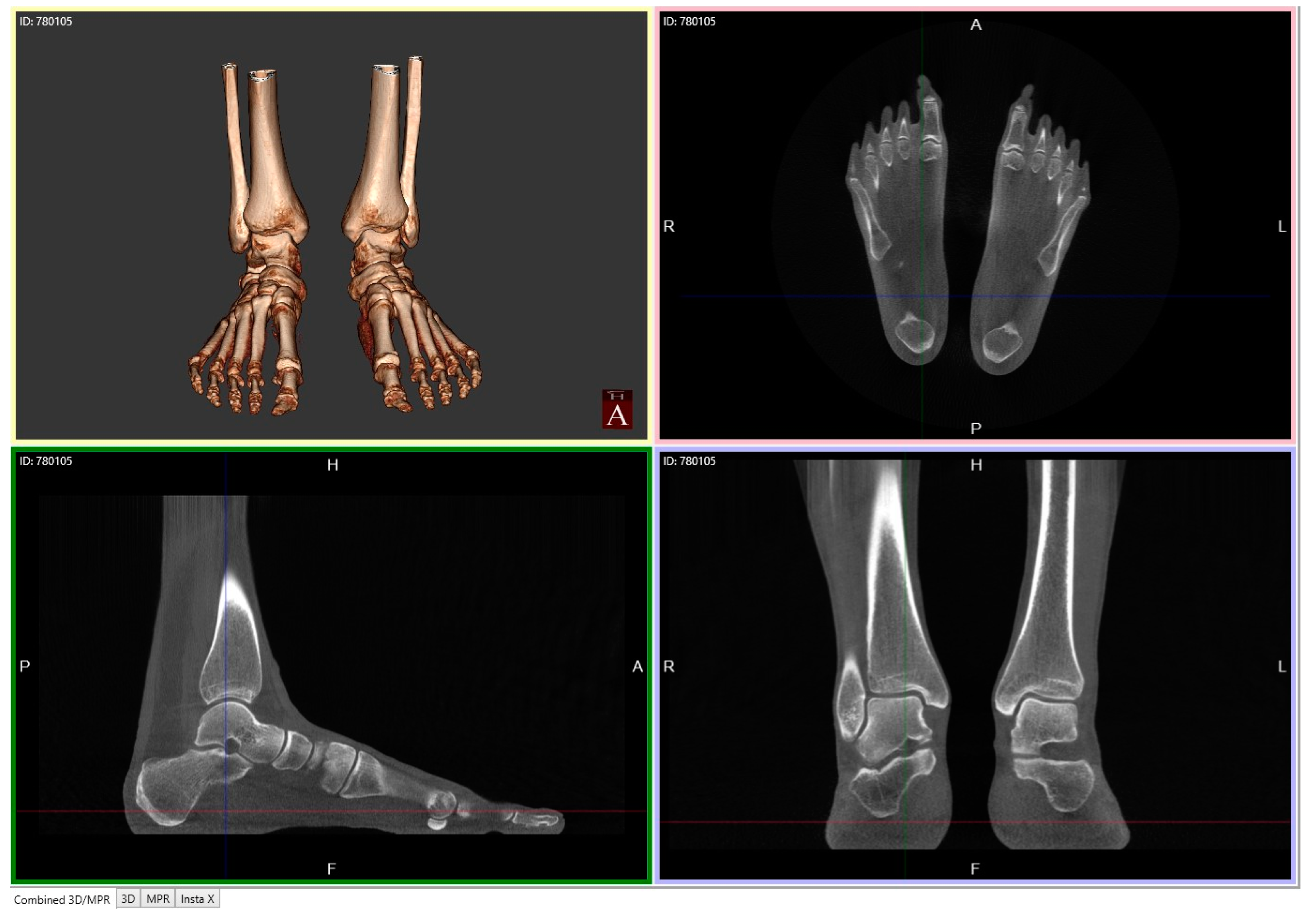 Applsci 14 05562 g006