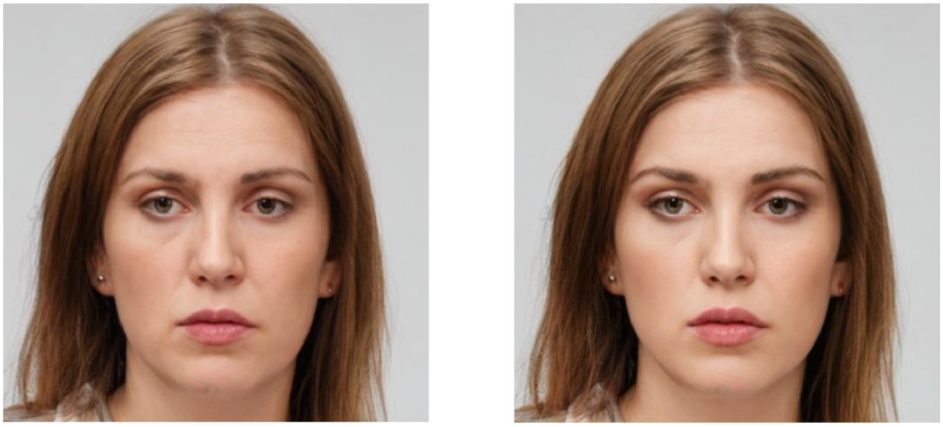 Applsci 14 07837 g007