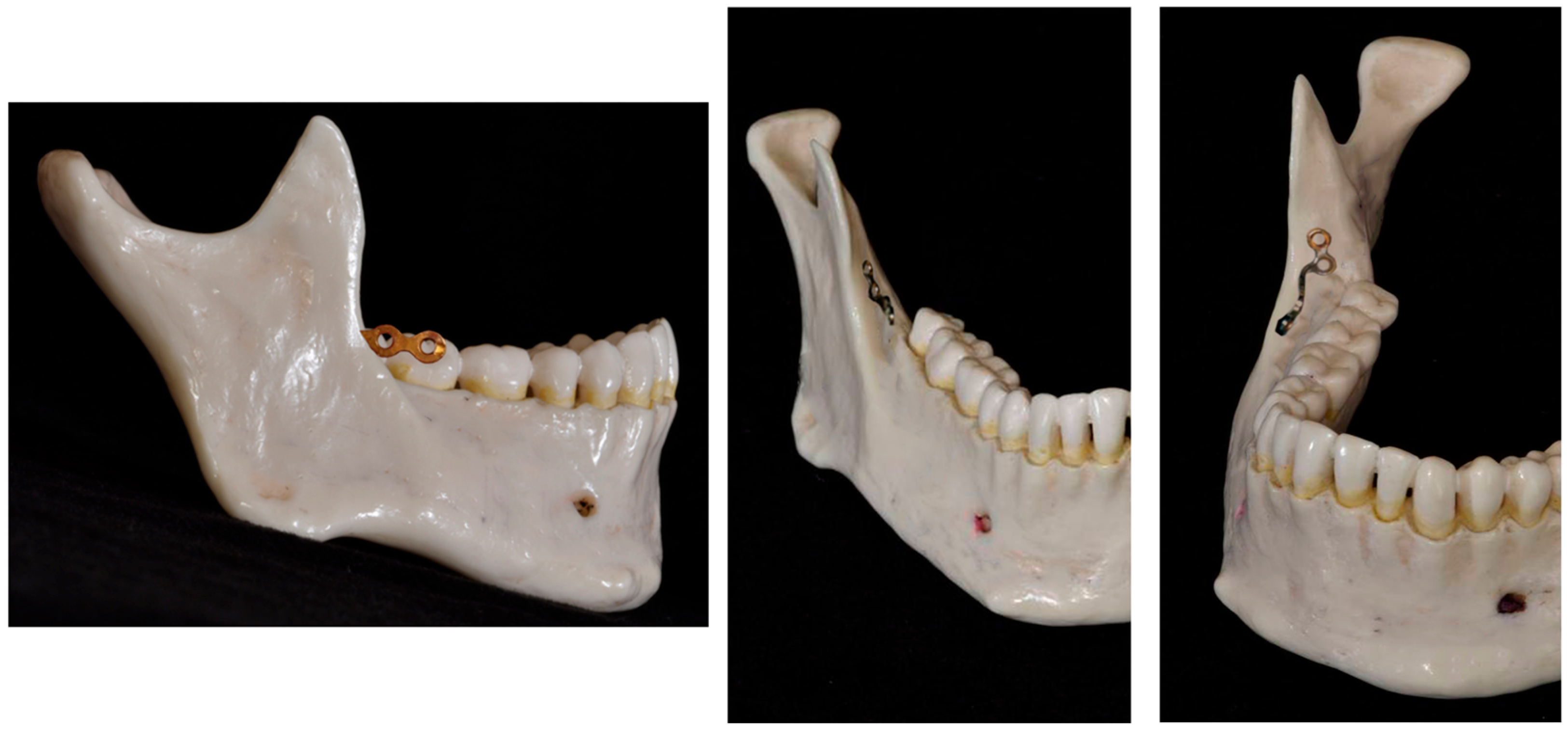 Applsci 14 11157 g001