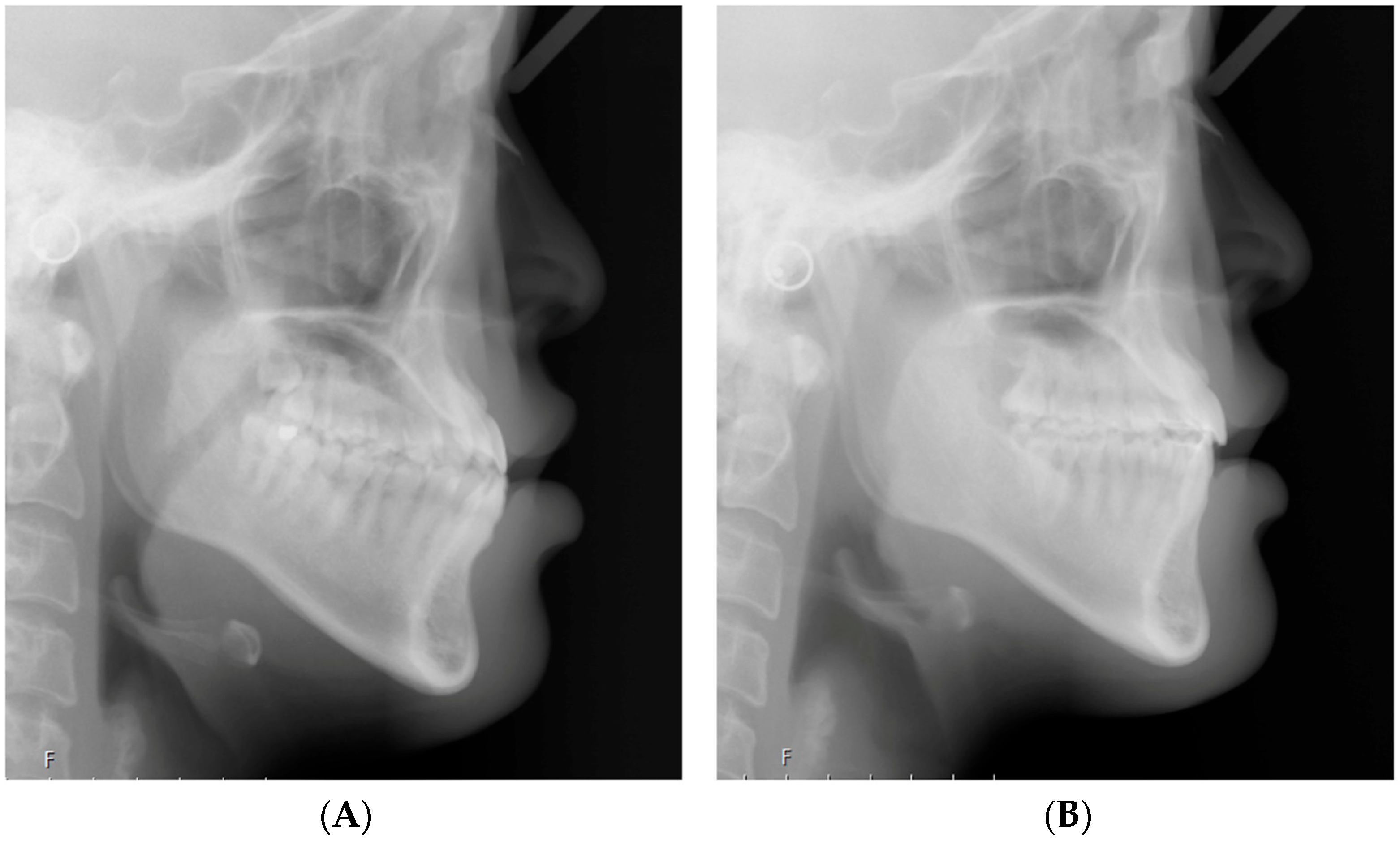 Applsci 14 11157 g007