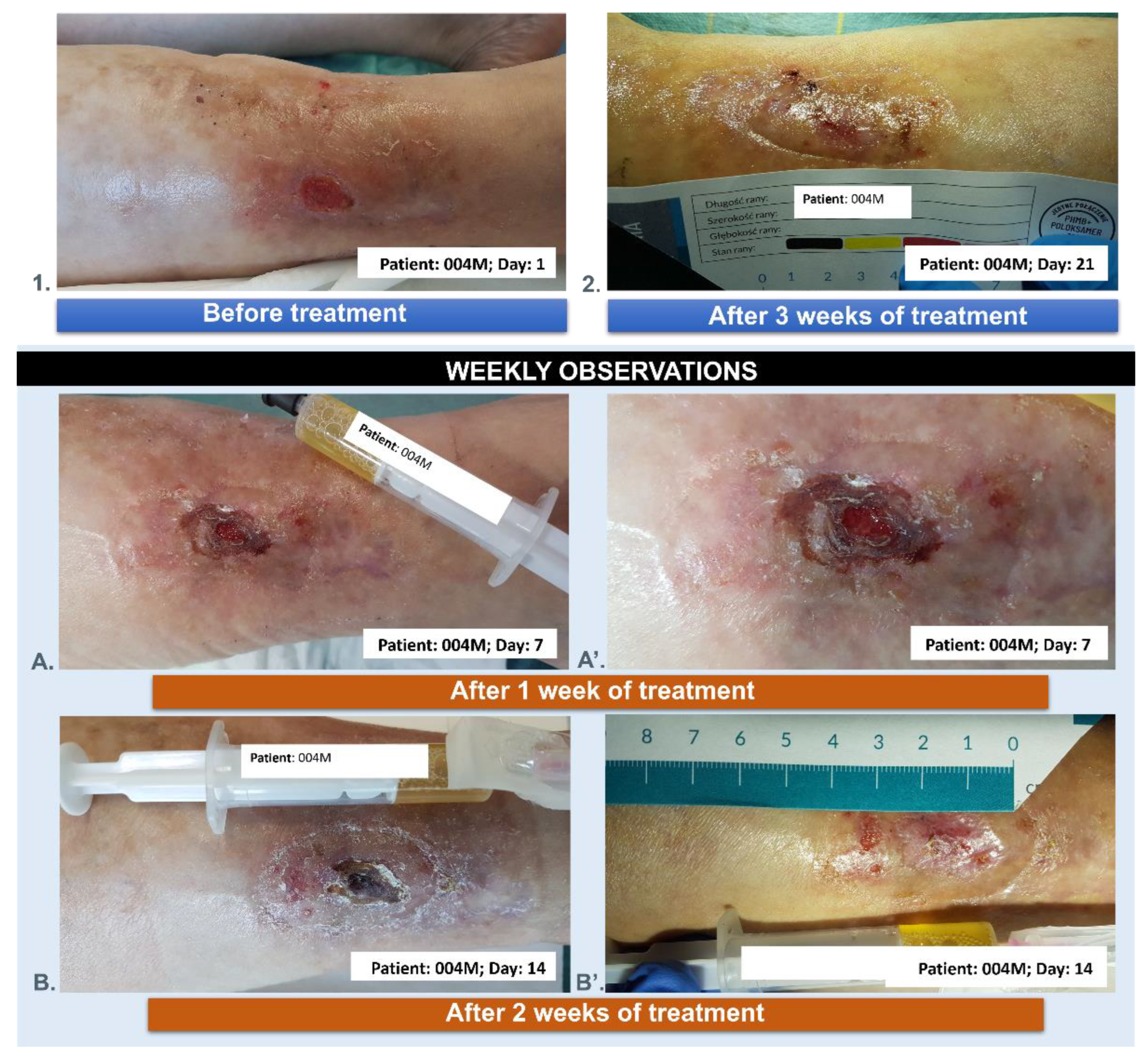 Applsci 14 11200 g014