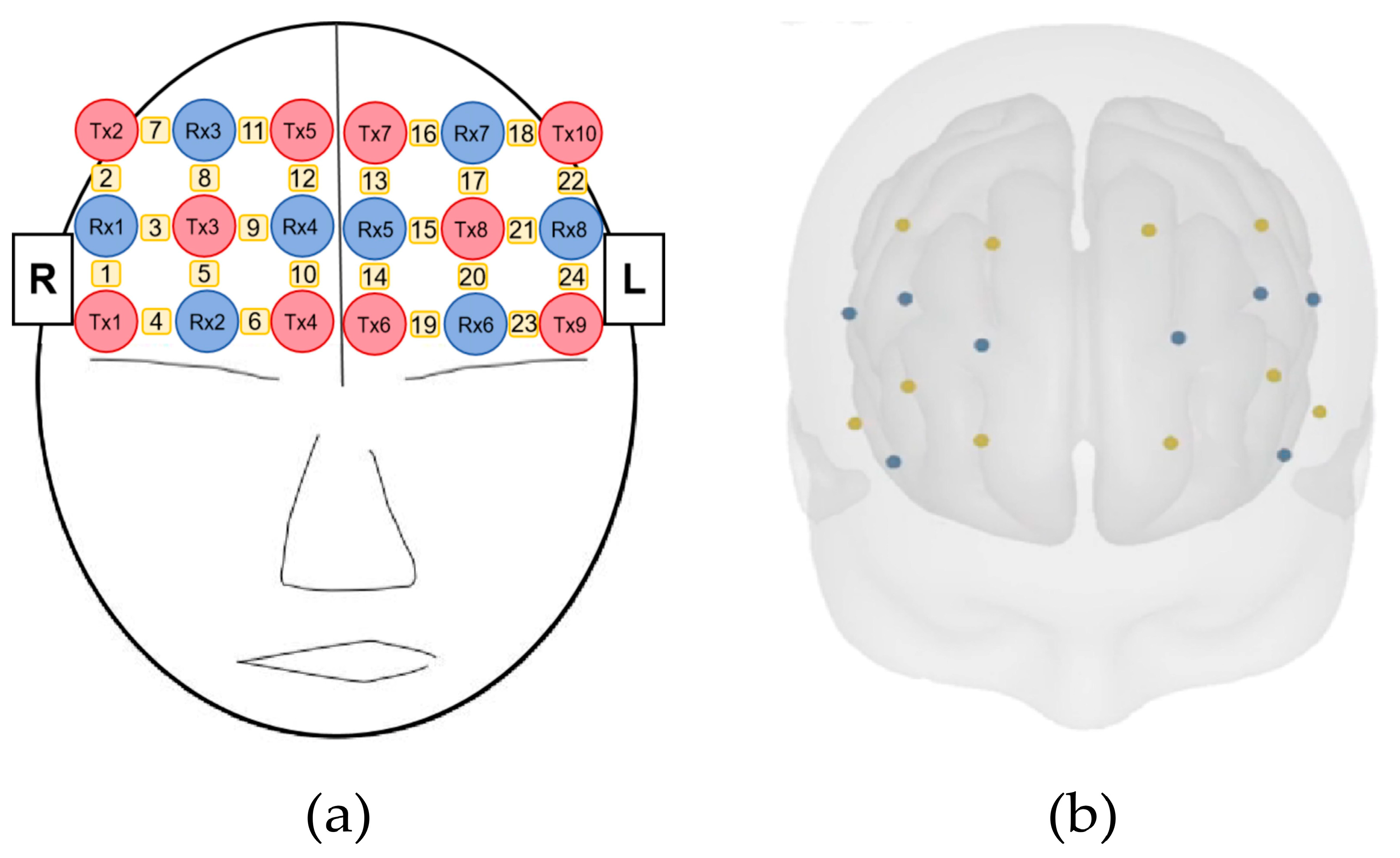 Applsci 15 02464 g004