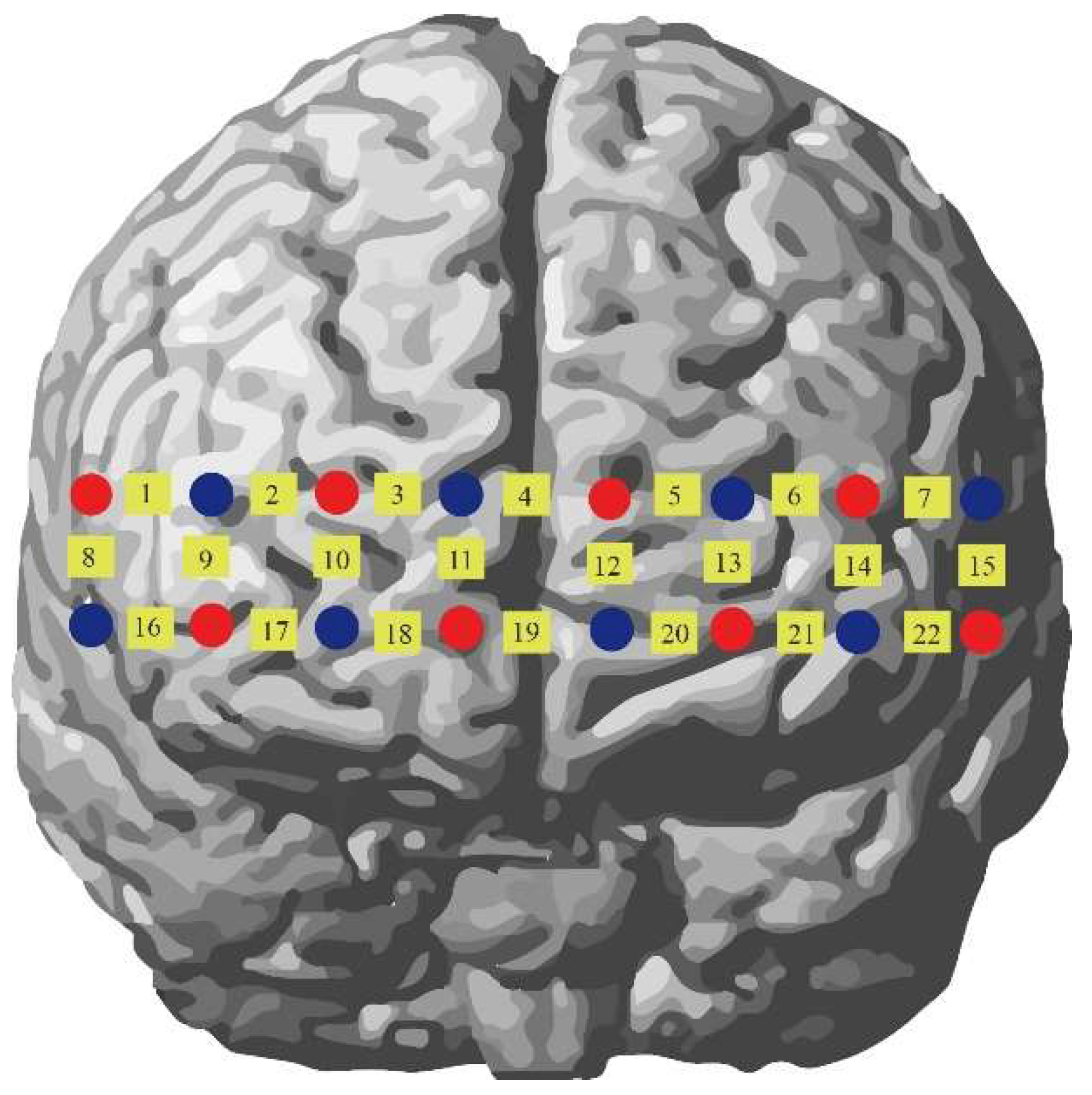 Applsci 15 04278 g004