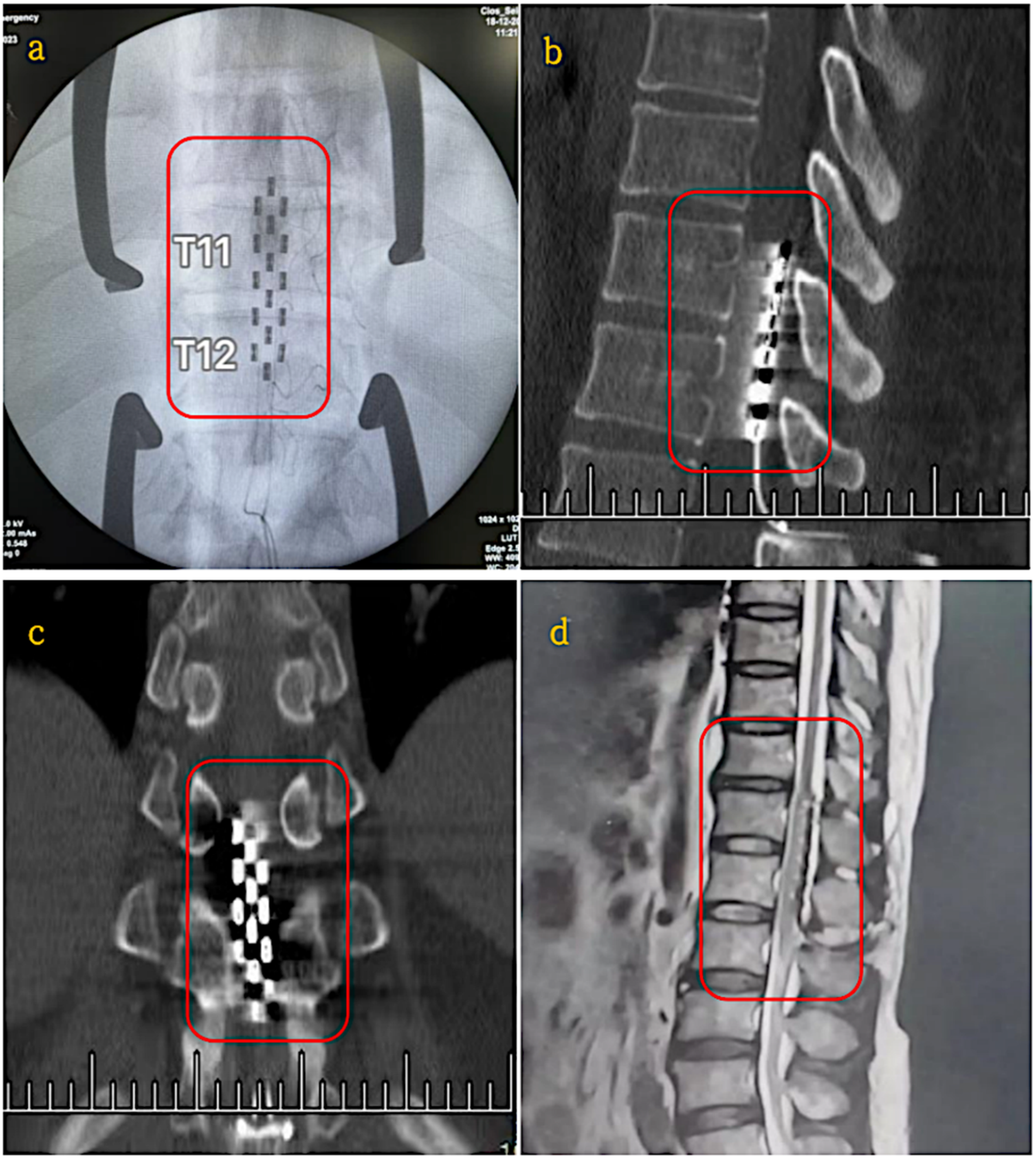 Applsci 15 08488 g003