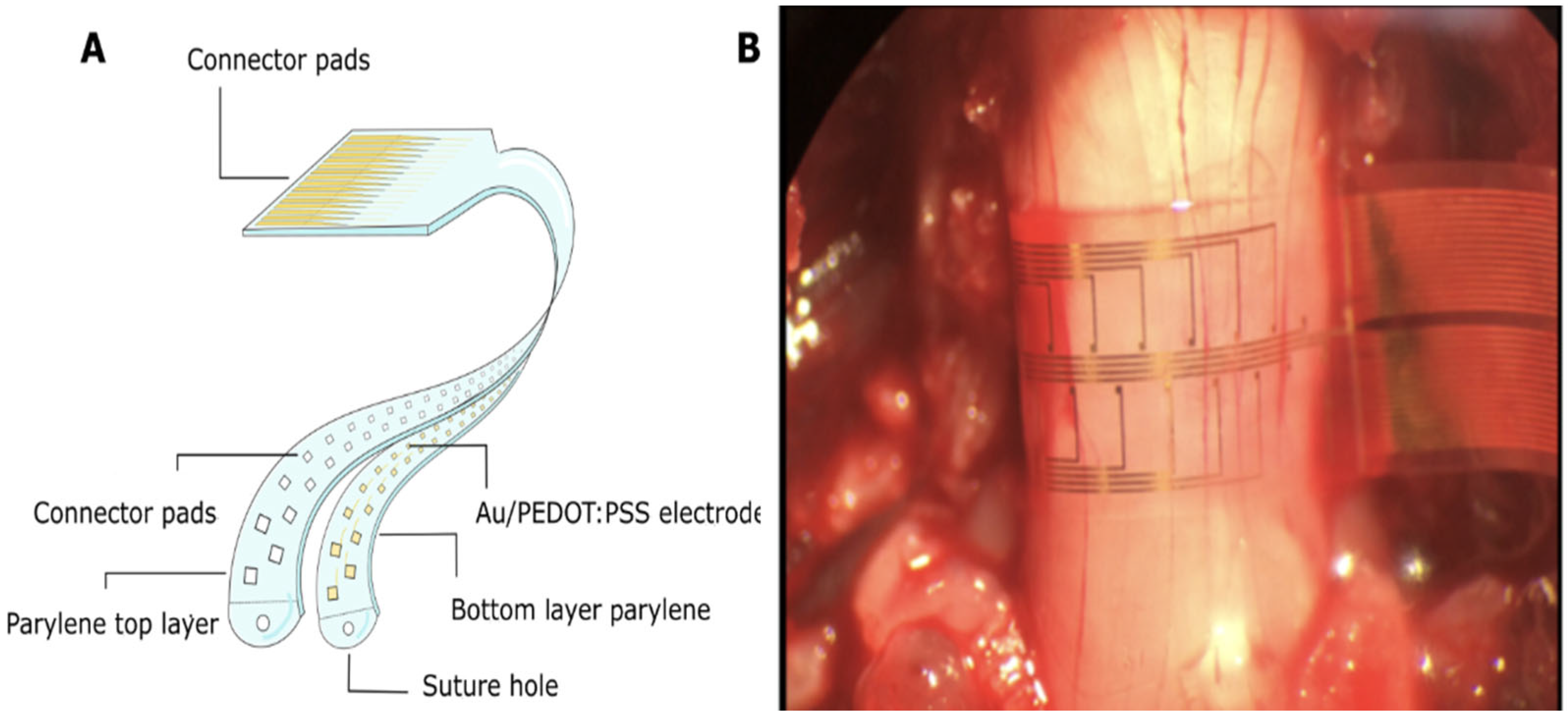 Applsci 15 08488 g004