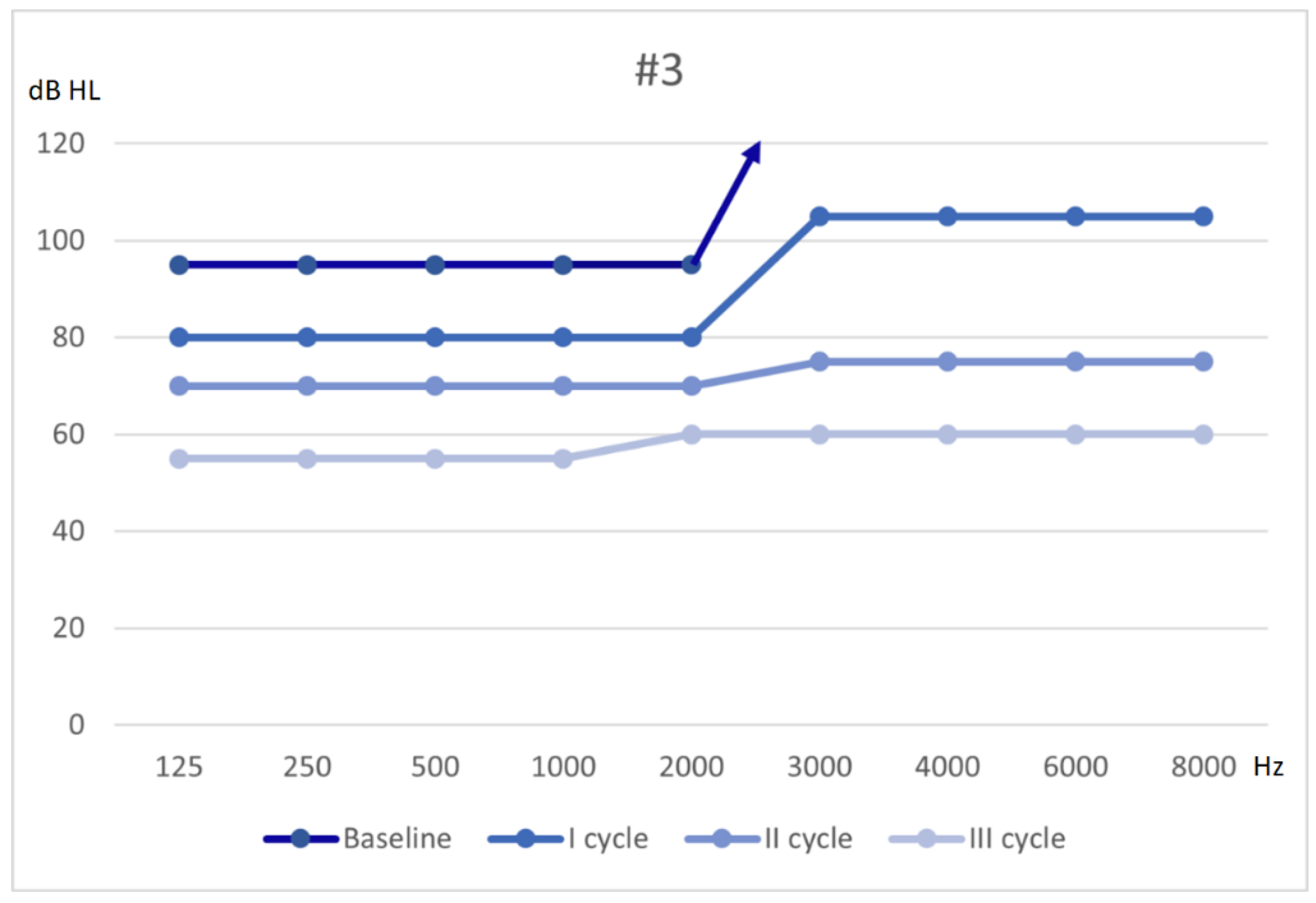 Audiology Research Free Full Text Sudden Sensorineural Hearing