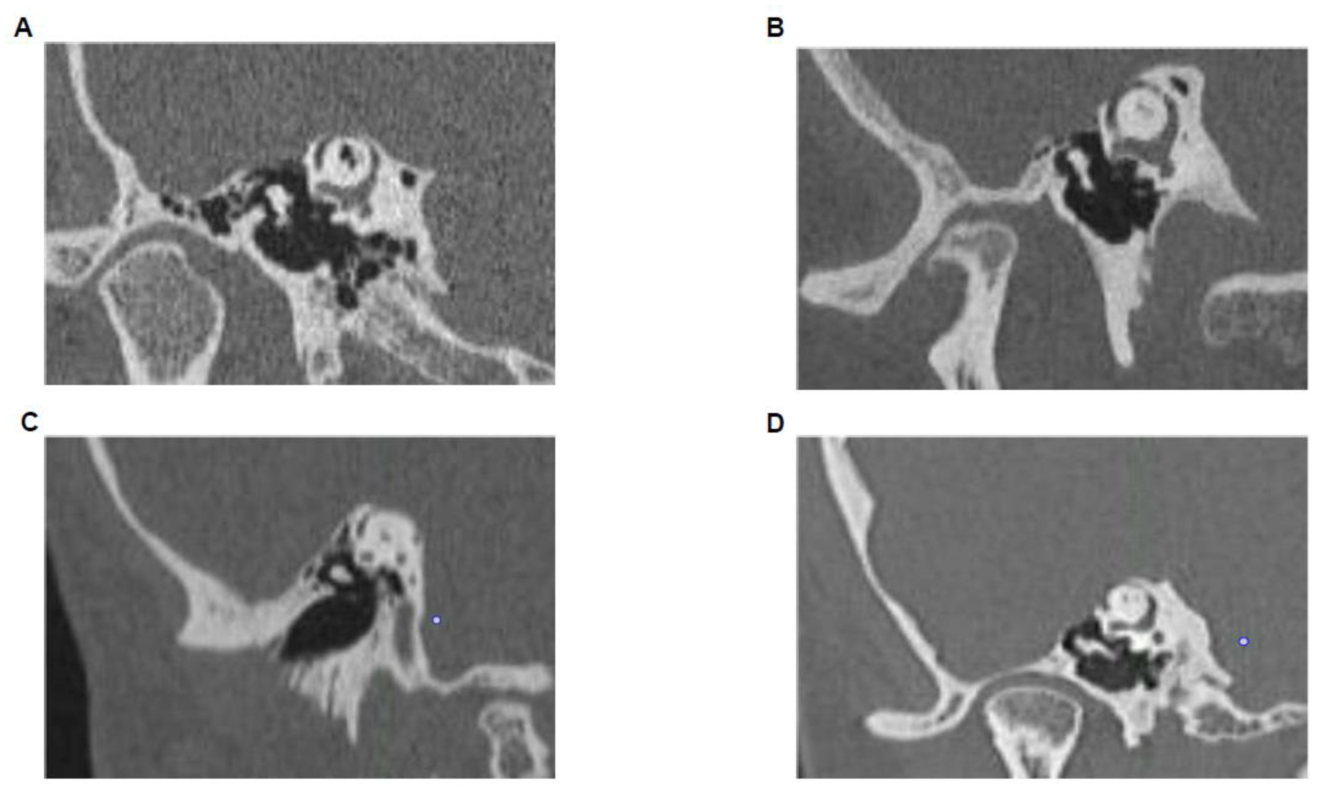 Audiolres 11 00042 g002