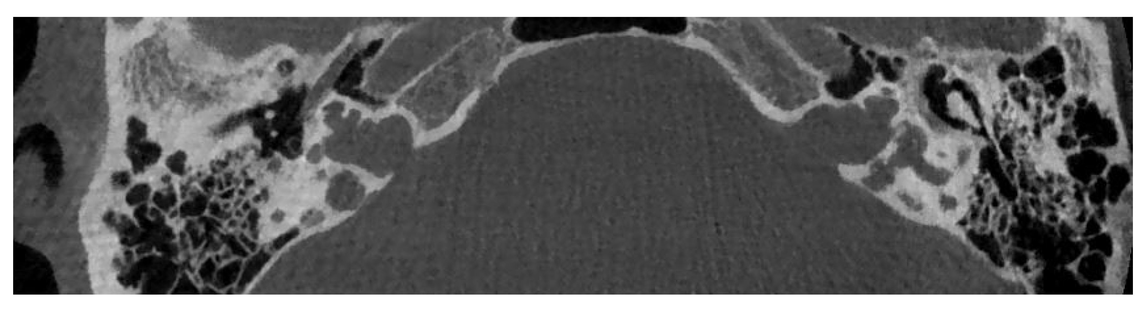 Audiolres 11 00047 g006 Audiolres 11 00047 g006