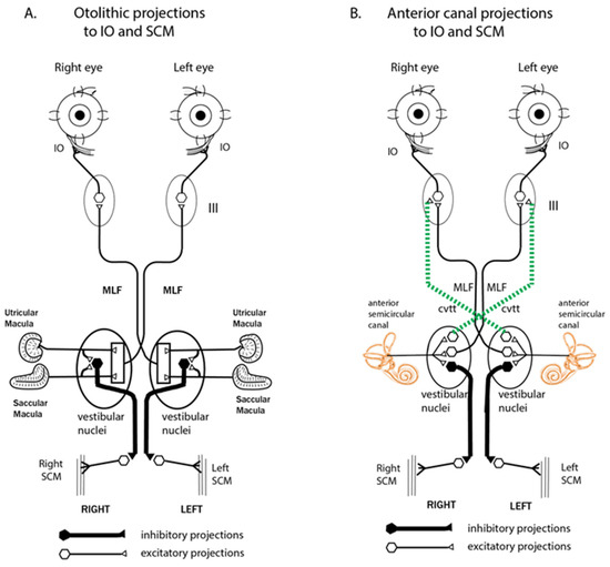 Audiology Research | Free Full-Text | A Review of Neural Data and ...