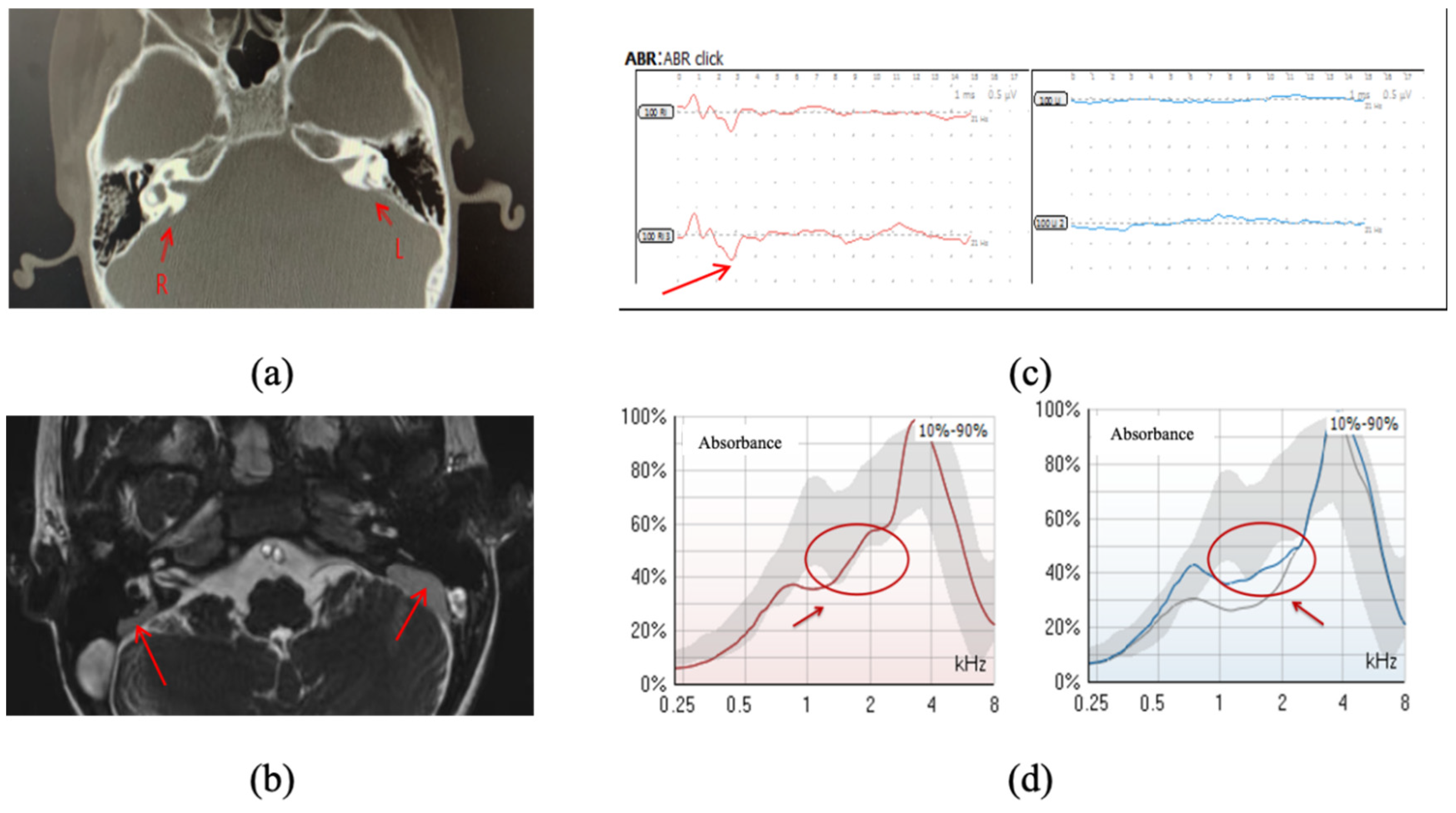 Audiolres 14 00058 g003