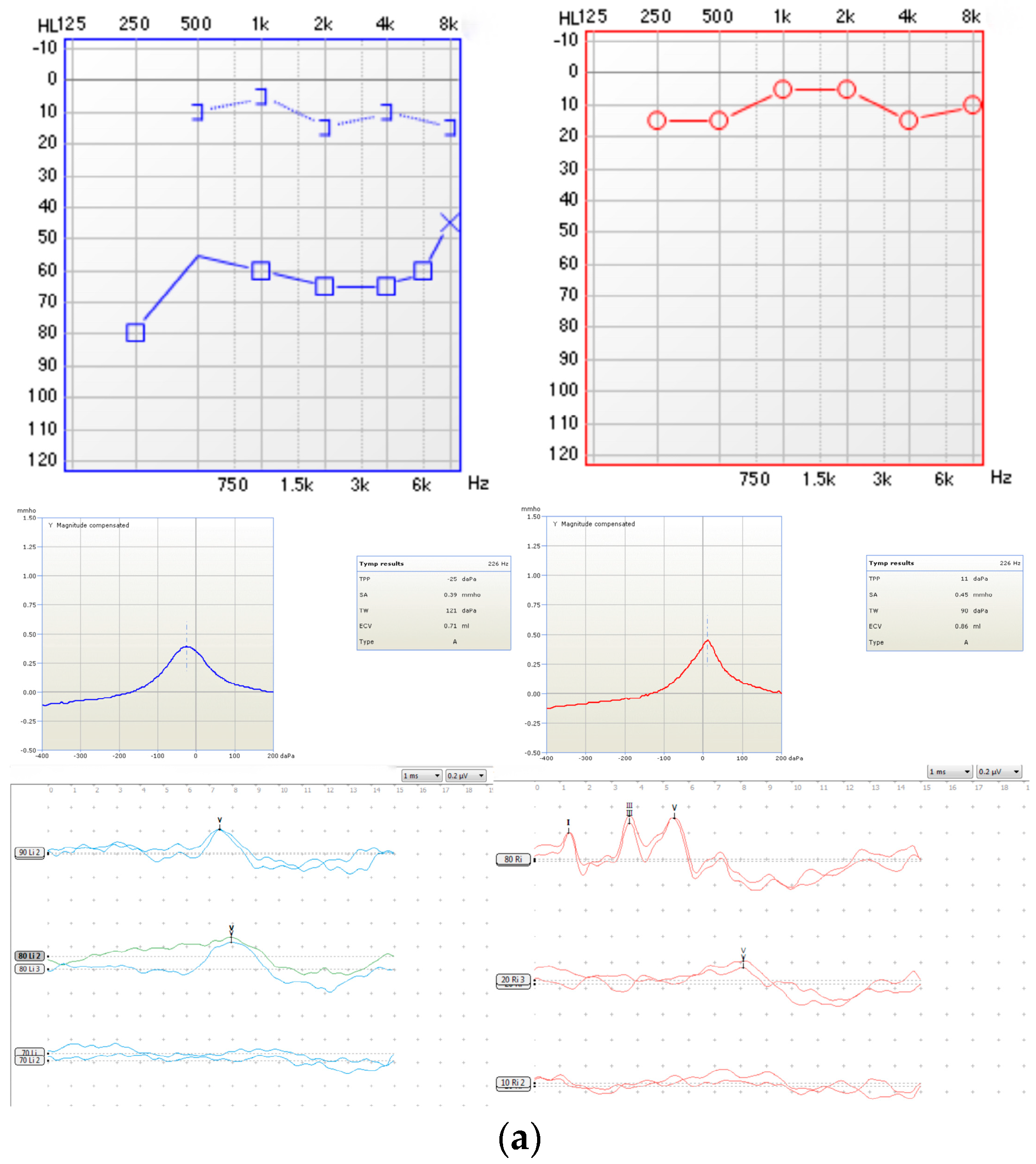 Audiolres 14 00058 g004a
