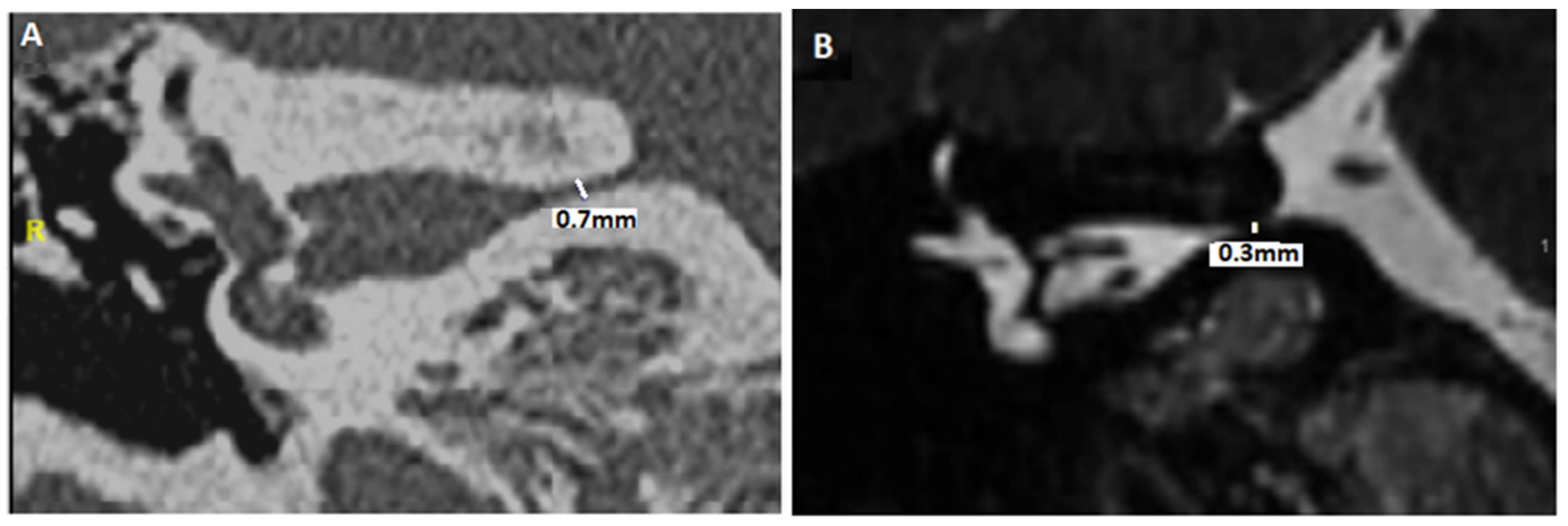 Audiolres 15 00028 g002 Audiolres 15 00028 g002