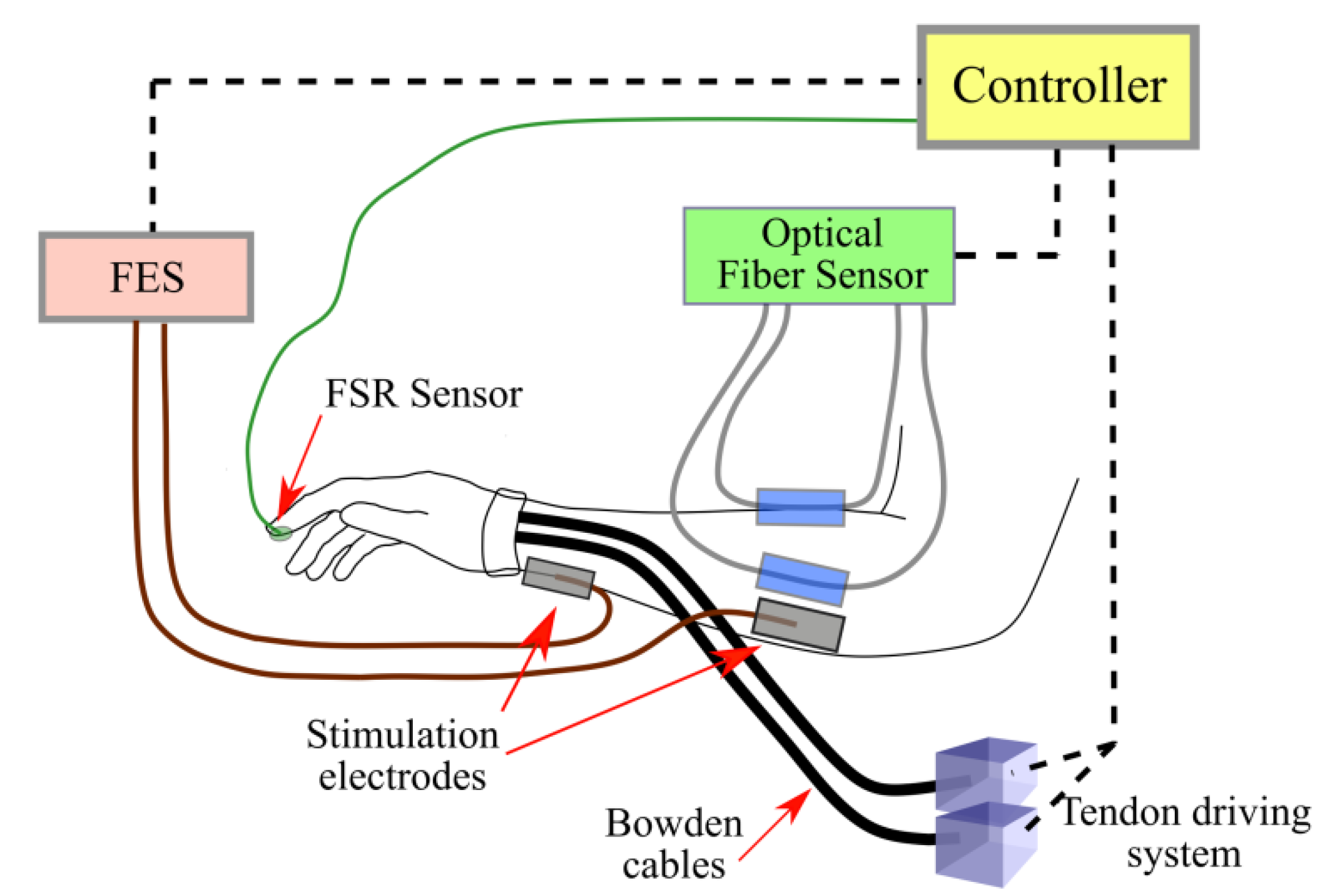 Automation | Free Full-Text | Design of Tendon-Actuated Robotic Glove  Integrated with Optical Fiber Force Myography Sensor